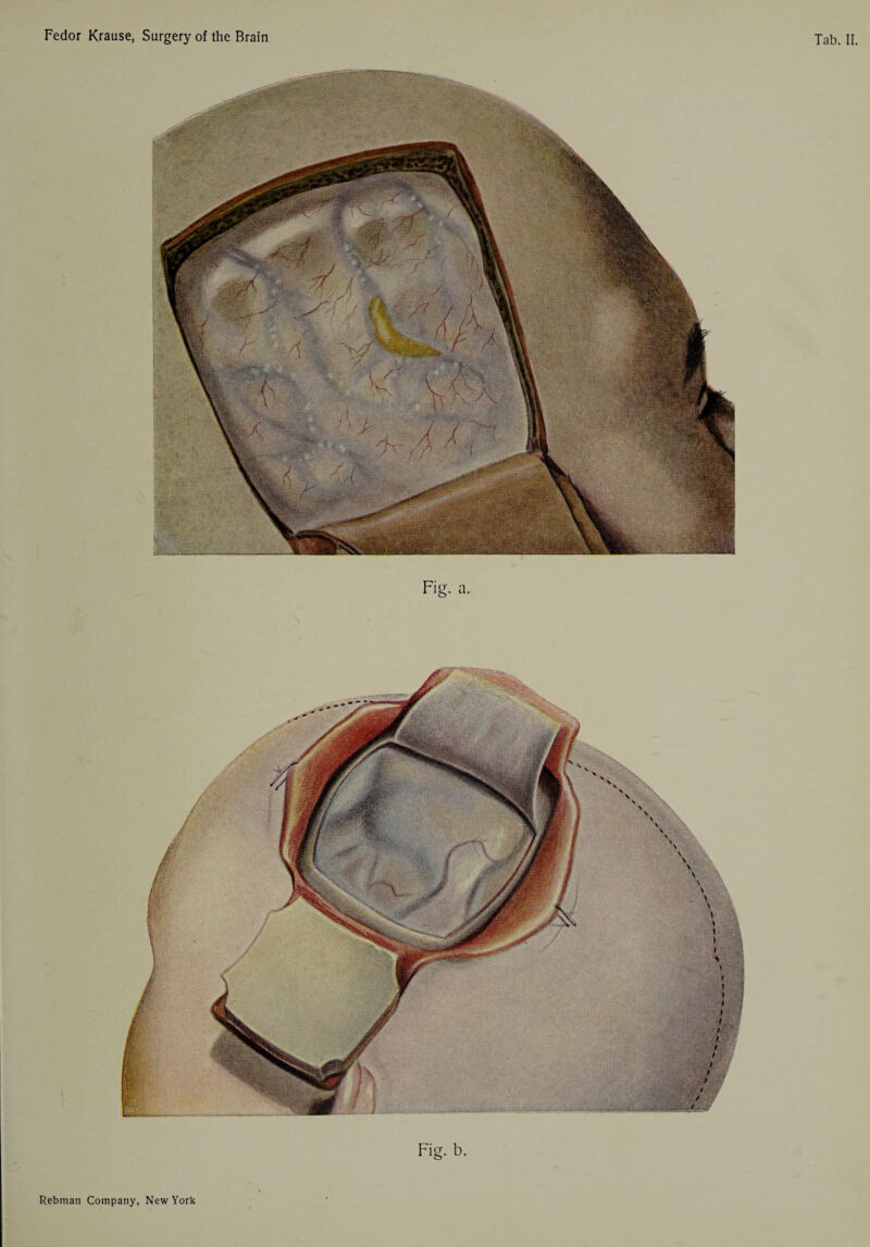 Fig. a. Fig. b. i t > ' * < r, i > t / / / y /