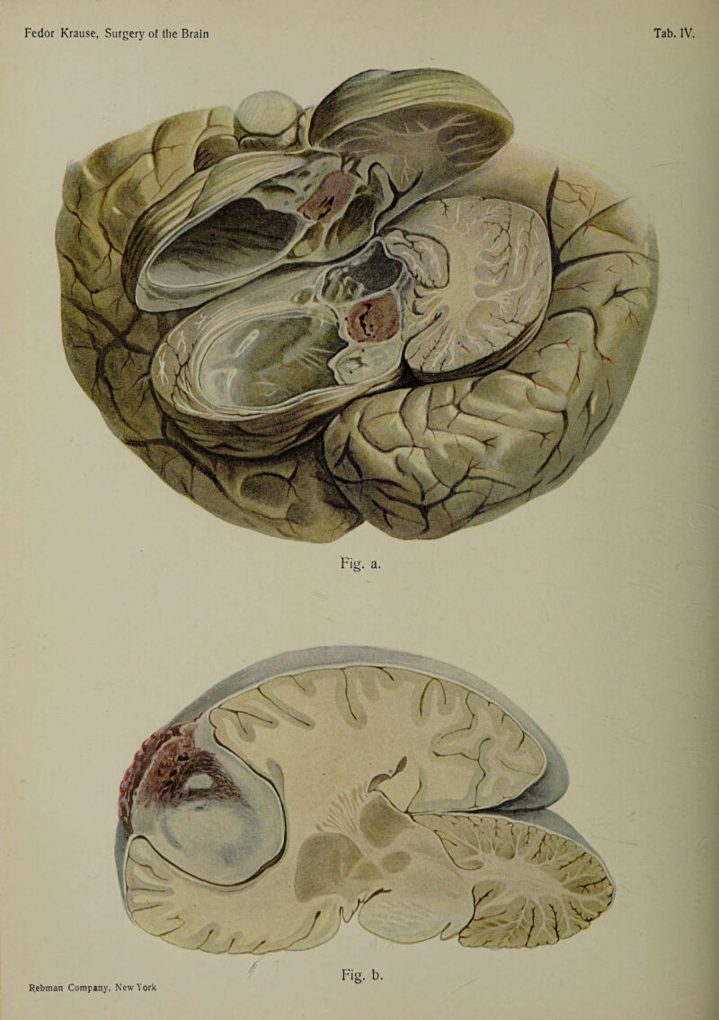 Rebman Company, New York Fig. b