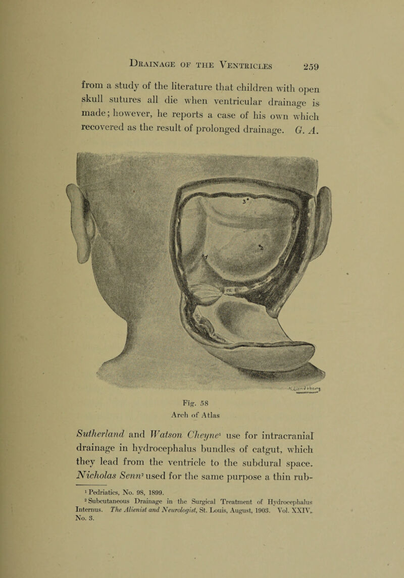 from a study of the literature that children with open skull sutures all die when ventricular drainage is made; however, he reports a case of his own which recovered as the result of prolonged drainage. G. A. Fig. 58 Arch of Atlas Sutherland and Watson Cheyne1 use for intracranial drainage in hydrocephalus bundles of catgut, which they lead from the ventricle to the subdural space. Nicholas Senn2 used for the same purpose a thin rub- 1 Pedriatics, No. 98, 1899. 2 Subcutaneous Drainage in the Surgical Treatment of Hydrocephalus Internus. The Alienist and Neurologist, St. Louis, August, 1903. Vol. XXIV, No. 3.