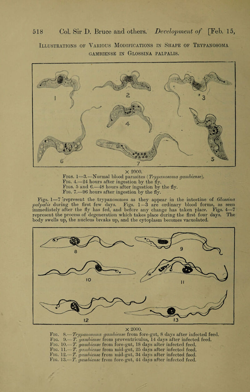 Illustrations of Various Modifications in Shape of Trypanosoma GAMBIENSE IN GLOSSINA PALPALIS. X 2000. Figs. 1—3.—Normal blood parasites ( Trypanosoma gambiense). Fig. 4.—24 hours after ingestion by the liy. Figs. 5 and 6.—48 hours after ingestion by the fly. Fig. 7.—96 hours after ingestion by the fly. Figs. 1—7 represent the trypanosomes as they appear in the intestine of Glossina palpalis during the first few days. Figs. 1—3 are ordinary blood forms, as seen immediately after the fly has fed, and before any change has taken place. Figs. 4—7 represent the process of degeneration which takes place during the first four days. The body swells up, the nucleus breaks up, and the cytoplasm becomes vacuolated. X 2000. Fig. 8.—Trypanosoma gambiense from fore-gut, 8 days after infected feed. Fig. 9.— T. gambiense from proventriculus, 14 days after infected feed. Fig. 10.— T. gambiense from fore-gut, 18 days after infected feed. Fig. 11.— T. gambiense from mid-gut, 25 days after infected feed. Fig. 12.— T. gambiense from mid-gut, 34 days after infected feed. Fig. 13.—T. gambiense from fore-gut, 44 days after infected feed.