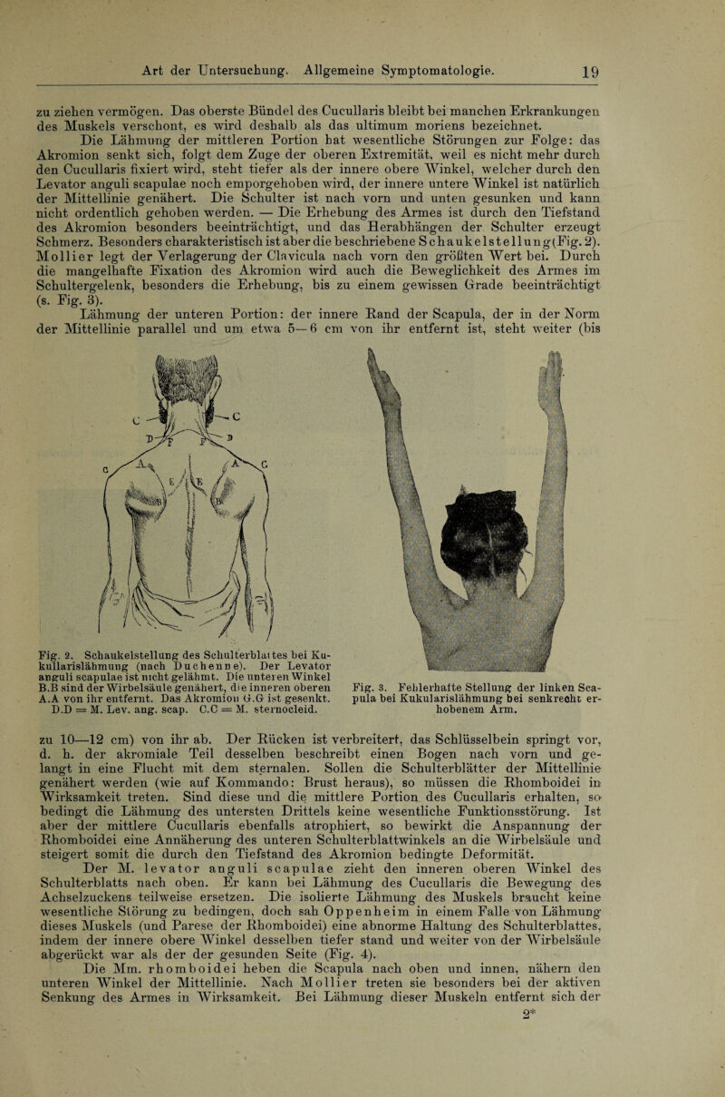 zu ziehen vermögen. Das oberste Bündel des Cucullaris bleibt bei manchen Erkrankungen des Muskels verschont, es wird deshalb als das ultimum moriens bezeichnet. Die Lähmung der mittleren Portion hat wesentliche Störungen zur Folge: das Akromion senkt sich, folgt dem Zuge der oberen Extremität, weil es nicht mehr durch den Cucullaris fixiert wird, steht tiefer als der innere obere Winkel, welcher durch den Levator anguli scapulae noch emporgehoben wird, der innere untere Winkel ist natürlich der Mittellinie genähert. Die Schulter ist nach vorn und unten gesunken und kann nicht ordentlich gehoben werden. — Die Erhebung des Armes ist durch den Tiefstand des Akromion besonders beeinträchtigt, und das Herabhängen der Schulter erzeugt Schmerz. Besonders charakteristisch ist aber die beschriebene Schaukelstellung(Fig. 2). Mollier legt der Verlagerung der Clavicula nach vorn den größten Wert bei. Durch die mangelhafte Fixation des Akromion wird auch die Beweglichkeit des Armes im Schultergelenk, besonders die Erhebung, bis zu einem gewissen Grade beeinträchtigt (s. Fig. 3). Lähmung der unteren Portion: der innere Rand der Scapula, der in der Norm der Mittellinie parallel und um etwa 5—6 cm von ihr entfernt ist, steht weiter (bis Fig. 2. Schaukelstellung des Schulterblattes bei Ku- kullarislähmung (nach Duchenne). Der Levator anguli scapulae ist nicht gelähmt. Die unteren Winkel B.B sind der Wirbelsäule genähert, die inneren oberen A.A von ihr entfernt. Das Akromion (LGf ist gesenkt. D.D = M. Lev. ang. scap. C.C = M. sternocleid. Fig. 3. Fehlerhafte Stellung der linken Sca¬ pula bei Kukularislähmung bei senkrecht er¬ hobenem Arm. zu 10—12 cm) von ihr ab. Der Rücken ist verbreitert, das Schlüsselbein springt vor, d. h. der akromiale Teil desselben beschreibt einen Bogen nach vorn und ge¬ langt in eine Flucht mit dem sternalen. Sollen die Schulterblätter der Mittellinie genähert werden (wie auf Kommando: Brust heraus), so müssen die Rhomboidei in Wirksamkeit treten. Sind diese und die mittlere Portion des Cucullaris erhalten, so bedingt die Lähmung des untersten Drittels keine wesentliche Funktionsstörung. Ist aber der mittlere Cucullaris ebenfalls atrophiert, so bewirkt die Anspannung der Rhomboidei eine Annäherung des unteren Schulterblattwinkels an die Wirbelsäule und steigert somit die durch den Tiefstand des Akromion bedingte Deformität. Der M. levator anguli scapulae zieht den inneren oberen Winkel des Schulterblatts nach oben. Er kann bei Lähmung des Cucullaris die Bewegung des Achselzuckens teilweise ersetzen. Die isolierte Lähmung des Muskels braucht keine wesentliche Störung zu bedingen, doch sah Oppenheim in einem Falle von Lähmung dieses Muskels (und Parese der Rhomboidei) eine abnorme Haltung des Schulterblattes, indem der innere obere Winkel desselben tiefer stand und weiter von der Wirbelsäule abgerückt war als der der gesunden Seite (Fig. 4). Die Mm. rhomboidei heben die Scapula nach oben und innen, nähern den unteren Winkel der Mittellinie. Nach Mollier treten sie besonders bei der aktiven Senkung des Armes in Wirksamkeit. Bei Lähmung dieser Muskeln entfernt sich der