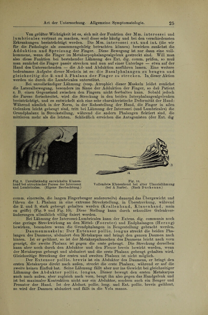 Von größter Wichtigkeit ist es, sich mit der Funktion der Mm. interossei und lumbricales vertraut zu machen, weil diese sehr häufig und bei den verschiedensten Erkrankungen beeinträchtigt werden. Die Mm. interossei ext. und int. (die wir für die Pathologie als zusammengehörig betrachten können) bewirken zunächst die Adduktion und Spreizung der Finger. Diese Bewegung ist nur dann eine voll¬ kommene, wenn die Finger im Metakarpophalangealgelenk gestreckt sind. Will man also diese Funktion bei bestehender Lähmung des Ext. dig. comm. prüfen, so muß man zunächst die Finger passiv strecken und nun auf einer Unterlage — etwa auf der Hand des Untersuchenden — die Ad- und Abduktion ausführen lassen. Eine weitere bedeutsame Aufgabe dieser Muskeln ist es: die Basalphalangen zu beugen und gleichzeitig die 2. und 3. Phalanx der Finger zu strecken. In dieser Aktion werden sie durch die Lumbricales unterstützt. Bei unvollständiger Lähmung (resp. Atrophie) dieser Muskeln leidet zunächst die Lateralbewegung, besonders im Sinne der Adduktion der Finger, so daß Patient z. B. einen Gegenstand zwischen den Fingern nicht festhalten kann. Sobald jedoch die Parese fortschreitet, wird die Streckung in den beiden Interphalangealgelenken beeinträchtigt, und es entwickelt sich eine sehr charakteristische Deformität der Hand: Während nämlich in der Norm, in der Buhestellung der Hand, die Finger in allen Gelenken leicht gebeugt sind, tritt bei Lähmung der Interossei (und Lumbricales) die Grundphalanx in Strecksteilung, während die andern Phalangen flektiert sind, die mittleren mehr als die letzten. Schließlich erreichen die Antagonisten (der Ext. dig Fig. 9. Unvollständig entwickelte Klauen- kand bei atrophischer Parese der Interossei und Lumbricales. (Eigene Beobachtung.) Fig. 10. Vollendete Klauenhand bei alter Ulnarislähmung (bei A Narbe). (Nach Duchenne.) comm. einerseits, die langen Fingerbeuger andererseils) dauernd das Übergewicht und führen die 1. Phalanx in eine extreme Strecksteilung, in Überstreckung, während die 2. und 3. stark gebeugt gehalten werden (Krallenhand, Klauenhand, main en griffe) (Fig. 9 und Fig. 10). Diese Stellung kann durch sekundäre Gelenkver¬ änderungen allmählich völlig fixiert werden. Bei Lähmung der Interossei-Lumbricales kann der Extens. dig. communis noch eine geringe Streckwirkung an den Mittel- (Foerster) und Endphalangen (Herzog) bewirken, besonders wenn die Grundphalangen in Beugestellung gebracht werden. Daumenmuskeln: Der Extensor pollic. longus streckt die beiden Pha¬ langen des Daumens, abduziert den Metakarpus und bringt den ganzen Daumen nach hinten. Ist er gelähmt, so ist der Metakarpalknochen des Daumens leicht nach vorn geneigt, die zweite Phalanx ist gegen die erste gebeugt. Die Streckung derselben kann aber noch durch den Abduktor und den Flexor brevis bewirkt werden, wenn der Metakarpus gebeugt und abduziert und die erste Phalanx gebeugt gehalten wird. Gleichzeitige Streckung der ersten und zweiten Phalanx ist nicht möglich. Der Extensor pollic. brevis ist ein Abduktor des Daumens, er bringt den ersten Metakarpus direkt nach außen, streckt die erste Phalanx, während er auf die zweite keinen Einfluß hat. Seine Lähmung fällt aber nur ins Gewicht bei gleichzeitiger Lähmung des Abduktor pollic. longus. Dieser bewegt den ersten Metakarpus auch nach außen, aber zugleich nach vorn, beugt ihn also gegen das Handgelenk und ist bei maximaler Kontraktion nicht nur ein Abduktor, sondern auch ein Beuger und Pronator der Hand. Ist der Abduct. pollic. long. und Ext. pollic. brevis gelähmt, so wird der Daumen abduziert und fällt in die Yola manus.