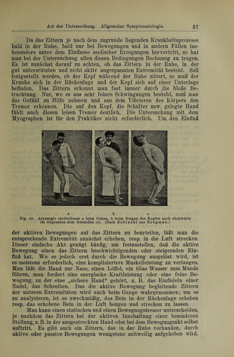 Da das Zittern je nach dem zugrunde liegenden Krankheitsprozesse bald in der Ruhe, bald nur bei Bewegungen und in andern Fällen ins¬ besondere unter dem Einflüsse seelischer Erregungen hervortritt, so hat man bei der Untersuchung allen diesen Bedingungen Rechnung zu tragen. Es ist zunächst darauf zu achten, ob das Zittern in der Ruhe, in der gut unterstützten und nicht aktiv angespannten Extremität bestellt. Soll festgestellt werden, ob der Kopf während der Ruhe zittert, so muß der Kranke sich in der Rückenlage und der Kopf sich auf einer Unterlage befinden. Das Zittern erkennt man fast immer durch ,die bloße Be¬ trachtung. Nur, wo es aus sehr feinen Schwingungen besteht, muß man das Gefühl zu Hilfe nehmen und aus dem Vibrieren des Körpers den Tremor erkennen. Die auf den Kopf, die Schulter usw. gelegte Hand fühlt auch diesen leisen Tremor deutlich. Die Untersuchung mit dem Myographen ist für den Praktiker nicht erforderlich. Um den Einfluß a b c Fig. 20. Asynergie c6r6belleuse a beim Gehen, b beim Neigen des Kopfes nach rückwärts im Gegensatz zum Gesunden (c). (Nach Babinski aus Bregman.) der aktiven Bewegungen auf das Zittern zu beurteilen, läßt man die entsprechende Extremität zunächst erheben, resp. in die Luft strecken. Dieser einfache Akt genügt häufig, um festzustellen, daß die aktive Bewegung einen das Zittern beschwichtigenden oder steigernden Ein¬ fluß hat. Wo es jedoch erst durch die Bewegung ausgelöst wird, ist es meistens erforderlich, eine kompliziertere Muskelleistung zu verlangen. Man läßt die Hand zur Nase, einen Löffel, ein Glas Wasser zum Munde führen, man fordert eine energische Kraftleistung oder eine feine Be¬ wegung, zu der eine „sichere Hand“ gehört, z. B. das Einfädeln einer Nadel, das Schreiben. Das die aktive Bewegung begleitende Zittern der unteren Extremitäten wird auch beim Gange wahrgenommen; um es zu analysieren, ist es zweckmäßig, das Bein in der Rückenlage erheben resp. das erhobene Bein in der Luft beugen und strecken zu lassen. Man kann einen statischen und einen Bewegungstremor unterscheiden, je nachdem das Zittern bei der aktiven Innehaltung einer besonderen Stellung, z.B. in der ausgestreckten Hand oder bei dem Bewegungsakt selbst auftritt. Es gibt auch ein Zittern, das in der Ruhe vorhanden, durch aktive oder passive Bewegungen wenigstens zeitweilig aufgehoben wird.