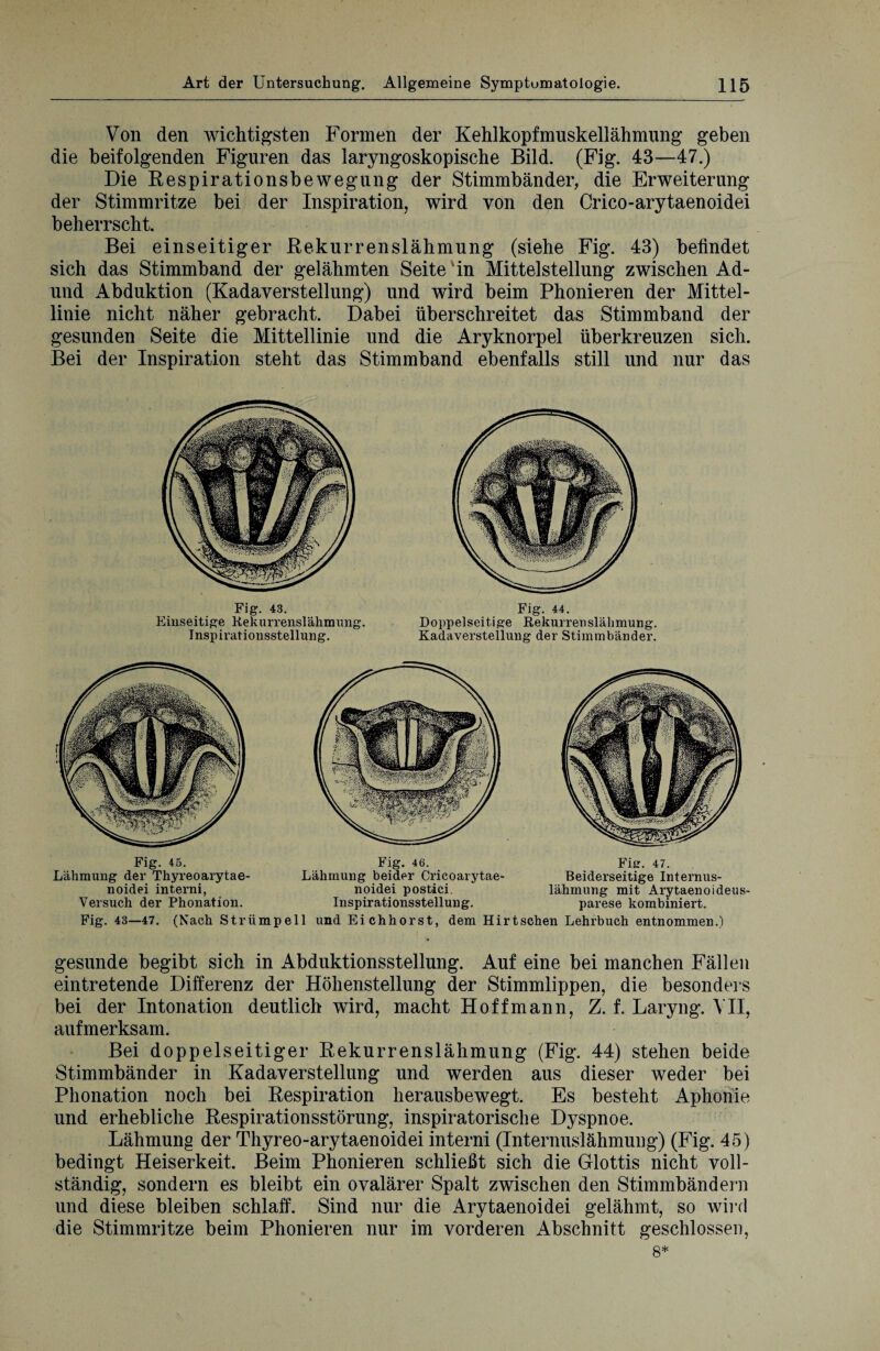 Von den wichtigsten Formen der Kehlkopfmuskellähmung geben die beifolgenden Figuren das laryngoskopische Bild. (Fig. 43—47.) Die Respirationsbewegung der Stimmbänder, die Erweiterung der Stimmritze bei der Inspiration, wird von den Crico-arytaenoidei beherrscht. Bei einseitiger Rekurrenslähmung (siehe Fig. 43) befindet sich das Stimmband der gelähmten Seite in Mittelstellung zwischen Ad- und Abduktion (Kadaverstellung) und wird beim Phonieren der Mittel¬ linie nicht näher gebracht. Dabei überschreitet das Stimmband der gesunden Seite die Mittellinie und die Aryknorpel überkreuzen sich. Bei der Inspiration steht das Stimmband ebenfalls still und nur das Fig. 43. Einseitige Rekurrenslähmung. Inspirationsstellung. Fig. 44. Doppelseitige Rekurrenslähmung. Kadaversteilung der Stimmbänder. Fig. 45. Lähmung der Thyreoarytae- noidei interni, Versuch der Phonation. Fig. 46. Lähmung beider Cricoarytae- noidei postici. Inspirationsstellung. Fig. 47. Beiderseitige Internus¬ lähmung mit Arytaenoideus- parese kombiniert. Fig. 43—47. (Nach Strümpell und Eichhorst, dem Hirtschen Lehrbuch entnommen.) gesunde begibt sich in Abduktionsstellung. Auf eine bei manchen Fällen eintretende Differenz der Höhenstellung der Stimmlippen, die besonders bei der Intonation deutlich wird, macht Hoffmann, Z. f. Laryng. VII, aufmerksam. Bei doppelseitiger Rekurrenslähmung (Fig. 44) stehen beide Stimmbänder in Kadaverstellung und werden aus dieser weder bei Phonation noch bei Respiration herausbewegt. Es besteht Aphonie und erhebliche Respirationsstörung, inspiratorische Dyspnoe. Lähmung der Thyreo-arytaenoidei interni (Internuslähmung) (Fig. 45) bedingt Heiserkeit. Beim Phonieren schließt sich die Glottis nicht voll¬ ständig, sondern es bleibt ein ovalärer Spalt zwischen den Stimmbändern und diese bleiben schlaff. Sind nur die Arytaenoidei gelähmt, so wird die Stimmritze beim Phonieren nur im vorderen Abschnitt geschlossen, 8*