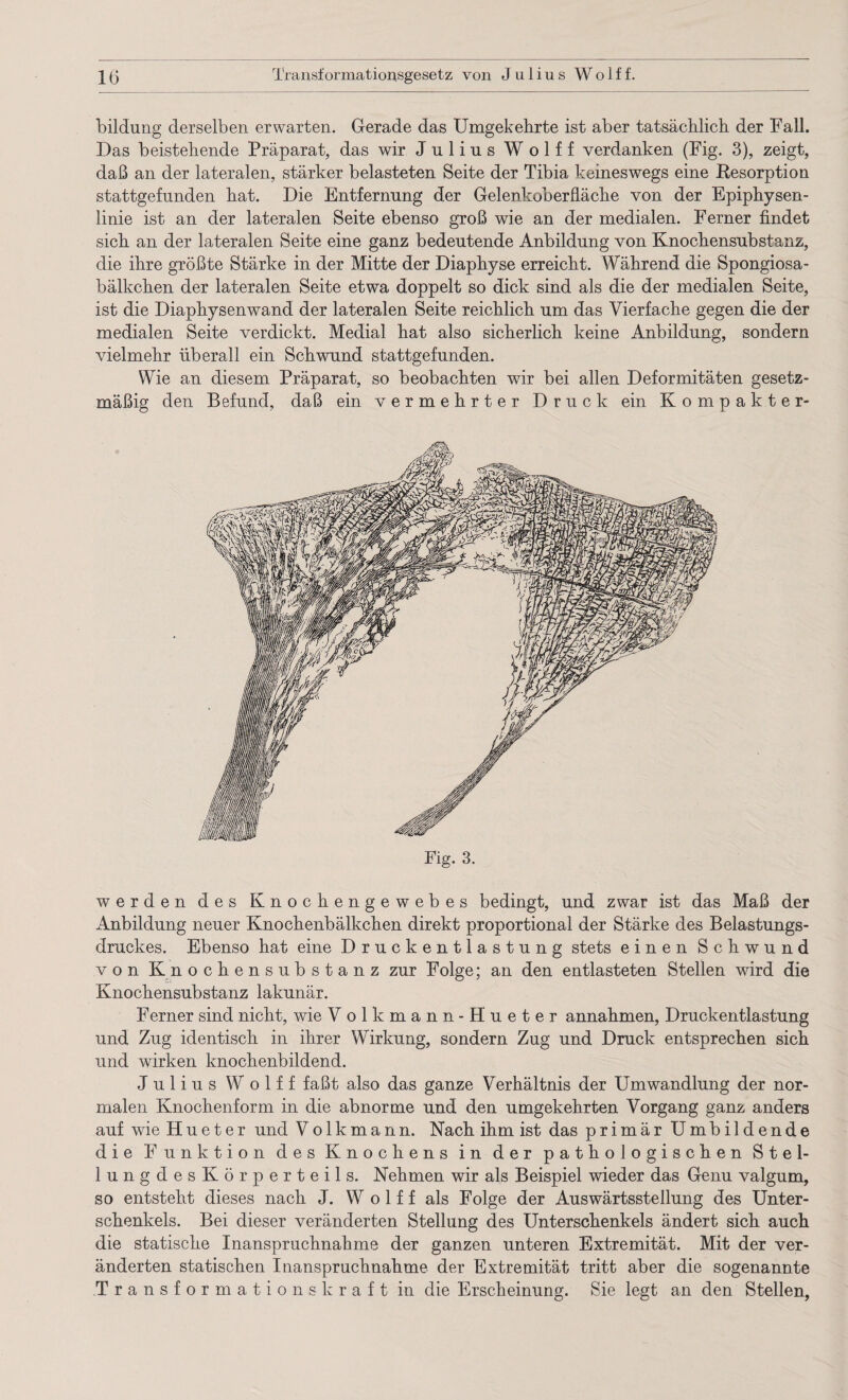 bildung derselben erwarten. Gerade das Umgekehrte ist aber tatsächlich der Fall. Das beistehende Präparat, das wir Julius Wolff verdanken (Fig. 3), zeigt, daß an der lateralen, stärker belasteten Seite der Tibia keineswegs eine Resorption stattgefunden hat. Die Entfernung der Gelenkoberfläche von der Epiphysen¬ linie ist an der lateralen Seite ebenso groß wie an der medialen. Ferner findet sich an der lateralen Seite eine ganz bedeutende Anbildung von Knochensubstanz, die ihre größte Stärke in der Mitte der Diaphyse erreicht. Während die Spongiosa- bälkchen der lateralen Seite etwa doppelt so dick sind als die der medialen Seite, ist die Diaphysenwand der lateralen Seite reichlich um das Vierfache gegen die der medialen Seite verdickt. Medial hat also sicherlich keine Anbildung, sondern vielmehr überall ein Schwund stattgefunden. Wie an diesem Präparat, so beobachten wir bei allen Deformitäten gesetz¬ mäßig den Befund, daß ein vermehrter Druck ein Kompakter¬ werden des Knochengewebes bedingt, und zwar ist das Maß der Anbildung neuer Knochenbälkchen direkt proportional der Stärke des Belastungs¬ druckes. Ebenso hat eine Druckentlastung stets einen Schwund von Knochensubstanz zur Folge; an den entlasteten Stellen wird die Knochensubstanz lakunär. Ferner sind nicht, wie V olkmann-Hueter annahmen, Druckentlastung und Zug identisch in ihrer Wirkung, sondern Zug und Druck entsprechen sich und wirken knochenbildend. Julius Wolff faßt also das ganze Verhältnis der Umwandlung der nor¬ malen Knochenform in die abnorme und den umgekehrten Vorgang ganz anders auf wie Hueter und Volkmann. Nach ihm ist das primär Umbildende die Funktion des Knochens in der pathologischen Stel- lungdesKörperteils. Nehmen wir als Beispiel wieder das Genu valgum, so entsteht dieses nach J. W o 1 f f als Folge der Auswärtsstellung des Unter¬ schenkels. Bei dieser veränderten Stellung des Unterschenkels ändert sich auch die statische Inanspruchnahme der ganzen unteren Extremität. Mit der ver¬ änderten statischen Inanspruchnahme der Extremität tritt aber die sogenannte Transformationskraft in die Erscheinung. Sie legt an den Stellen,