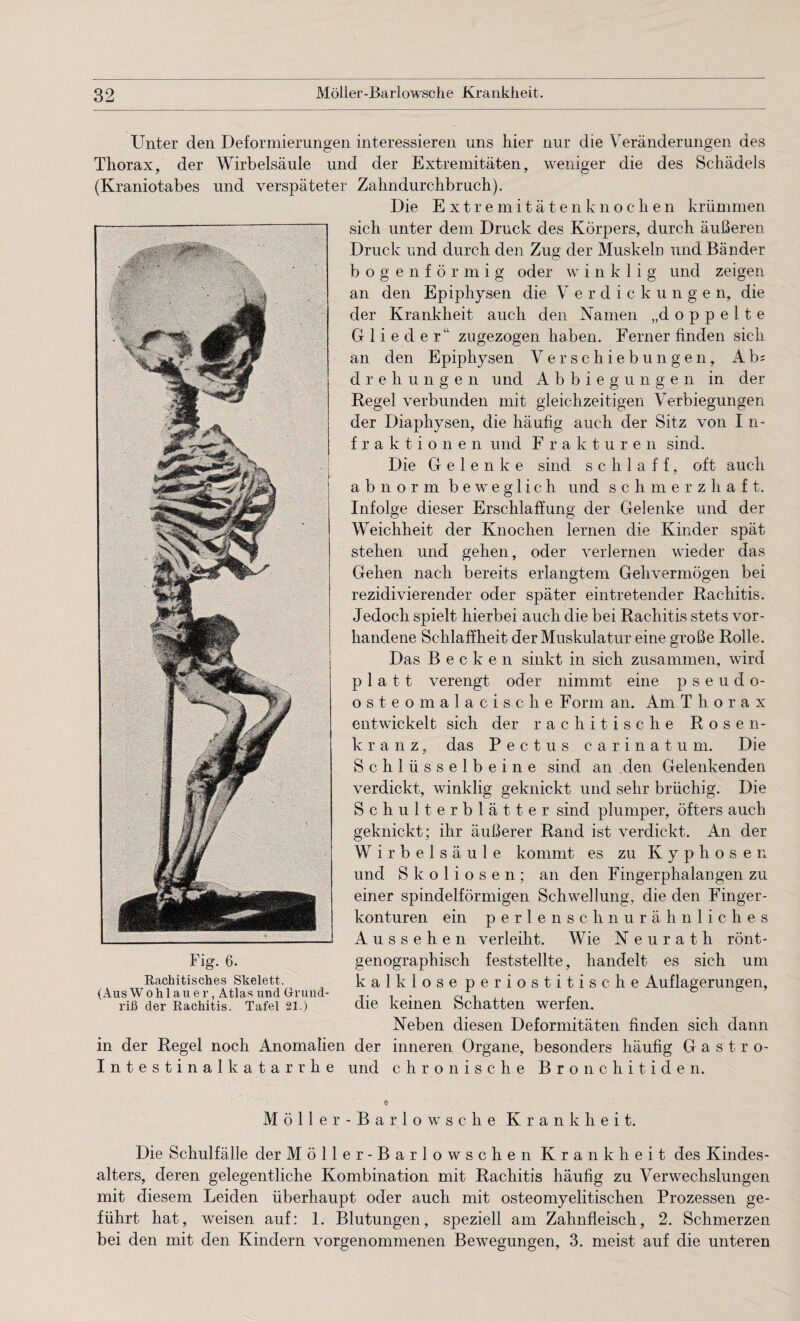 Unter den Deformierungen interessieren uns hier nur die Veränderungen des Thorax, der Wirbelsäule und der Extremitäten, weniger die des Schädels (Kraniotabes und verspäteter Zahndurchbruch). Die Extremitätenknochen krümmen sich unter dem Druck des Körpers, durch äußeren Druck und durch den Zug der Muskeln und Bänder bogenförmig oder winklig und zeigen an den Epiphysen die Verdickungen, die der Krankheit auch den Namen „doppelte Glieder“ zugezogen haben. Ferner finden sich an den Epiphysen Verschiebungen, A b= drehungen und Abbiegungen in der Regel verbunden mit gleichzeitigen Verbiegungen der Diaphysen, die häufig auch der Sitz von I n- f r a k t i o n e n und Frakturen sind. Die Gelenke sind schlaff, oft auch abnorm beweglich und schmerzhaft. Infolge dieser Erschlaffung der Gelenke und der Weichheit der Knochen lernen die Kinder spät stehen und gehen, oder verlernen wieder das Gehen nach bereits erlangtem Gehvermögen bei rezidivierender oder später eintretender Rachitis. Jedoch spielt hierbei auch die bei Rachitis stets vor¬ handene Schlaffheit der Muskulatur eine große Rolle. Das Becken sinkt in sich zusammen, wird platt verengt oder nimmt eine pseudo- osteomalacische Form an. Am Thorax entwickelt sich der rachitische Rosen¬ kranz, das P e c t u s carinatum. Die Schlüsselbeine sind an den Gelenkenden verdickt, winklig geknickt und sehr brüchig. Die Schulterblätter sind plumper, öfters auch geknickt; ihr äußerer Rand ist verdickt. An der Wirbelsäule kommt es zu Kyphosen und Skoliosen; an den Fingerphalangen zu einer spindelförmigen Schwellung, die den Finger¬ konturen ein perlenschnurähnliches Aussehen verleiht. Wie Neurath rönt¬ genographisch feststellte, handelt es sich um kalklose periostitis che Auflagerungen, die keinen Schatten werfen. Neben diesen Deformitäten finden sich dann in der Regel noch Anomalien der inneren Organe, besonders häufig Gastro- Intestinalkatarrhe und chronische Bronchitiden. Fig. 6. Rachitisches Skelett. (Aus Wohl au er, Atlas und Grund¬ riß der Rachitis. Tafel 21.) Möller- Barlo ws che Krankheit. Die Schulfälle der Möller-Barlowschen Krankheit des Kindes¬ alters, deren gelegentliche Kombination mit Rachitis häufig zu Verwechslungen mit diesem Leiden überhaupt oder auch mit osteomyelitischen Prozessen ge¬ führt hat, weisen auf: 1. Blutungen, speziell am Zahnfleisch, 2. Schmerzen bei den mit den Kindern vorgenommenen Bewegungen, 3. meist auf die unteren