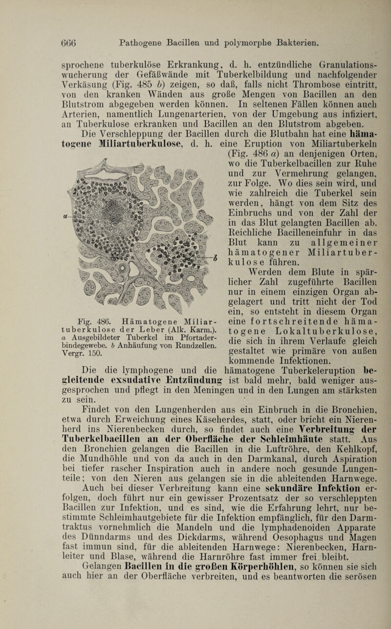 sprochene tuberkulöse Erkrankung, d. h. entzündliche Granulations¬ wucherung der Gefäßwände mit Tuberkelbildung und nachfolgender Verkäsung (Fig. 485 b) zeigen, so daß, falls nicht Thrombose eintritt, von den kranken Wänden aus große Mengen von Bacillen an den Blutstrom abgegeben werden können. In seltenen Fällen können auch Arterien, namentlich Lungenarterien, von der Umgebung aus infiziert, au Tuberkulose erkranken und Bacillen an den Blutstrom abgeben. Die Verschleppung der Bacillen durch die Blutbahn hat eine häma¬ togene Miliartuberkulose, d. h. eine Eruption von Miliartuberkeln (Fig. 486 a) an denjenigen Orten, wo die Tuberkelbacillen zur Ruhe und zur Vermehrung gelangen, zur Folge. Wo dies sein wird, und wie zahlreich die Tuberkel sein werden, hängt von dem Sitz des Einbruchs und von der Zahl der in das Blut gelangten Bacillen ab. Reichliche Bacilleneinfuhr in das Blut kann zu allgemeiner hämatogener Miliartuber¬ kulose führen. Werden dem Blute in spär¬ licher Zahl zugeführte Bacillen nur in einem einzigen Organ ab¬ gelagert und tritt nicht der Tod ein, so entsteht in diesem Organ eine fortschreitende häma¬ togene Lokaltuberkulose, die sich in ihrem Verlaufe gleich gestaltet wie primäre von außen kommende Infektionen. Die die lymphogene und die hämatogene Tuberkeleruption be¬ gleitende exsudative Entzündung ist bald mehr, bald weniger aus¬ gesprochen und pflegt in den Meningen und in den Lungen am stärksten zu sein. Findet von den Lungenherden aus ein Einbruch in die Bronchien, etwa durch Erweichung eines Käseherdes, statt, oder bricht ein Nieren¬ herd ins Nierenbecken durch, so findet auch eine Verbreitung* der Tuberkelbacillen an der Oberfläche der Schleimhäute statt. Aus den Bronchien gelangen die Bacillen in die Luftröhre, den Kehlkopf, die Mundhöhle und von da auch in den Darmkanal, durch Aspiration bei tiefer rascher Inspiration auch in andere noch gesunde Lungen¬ teile; von den Nieren aus gelangen sie in die ableitenden Harnwege. Auch bei dieser Verbreitung kann eine sekundäre Infektion er¬ folgen, doch führt nur ein gewisser Prozentsatz der so verschleppten Bacillen zur Infektion, und es sind, wie die Erfahrung lehrt, nur be¬ stimmte Schleimhautgebiete für die Infektion empfänglich, für den Darm- traktus vornehmlich die Mandeln und die lymphadenoiden Apparate des Dünndarms und des Dickdarms, während Oesophagus und Magen fast immun sind, für die ableitenden Harnwege: Nierenbecken, Harn¬ leiter und Blase, während die Harnröhre fast immer frei bleibt. Gelangen Bacillen in die großen Körperhöhlen, so können sie sich auch hier an der Oberfläche verbreiten, und es beantworten die serösen Fig. 486. Hämatogene Miliar¬ tuberkulose der Leber (Alk. Karm.). a Ausgebildeter Tuberkel im Pfortader¬ bindegewebe. b Anhäufung von Rundzellen. Yergr. 150.