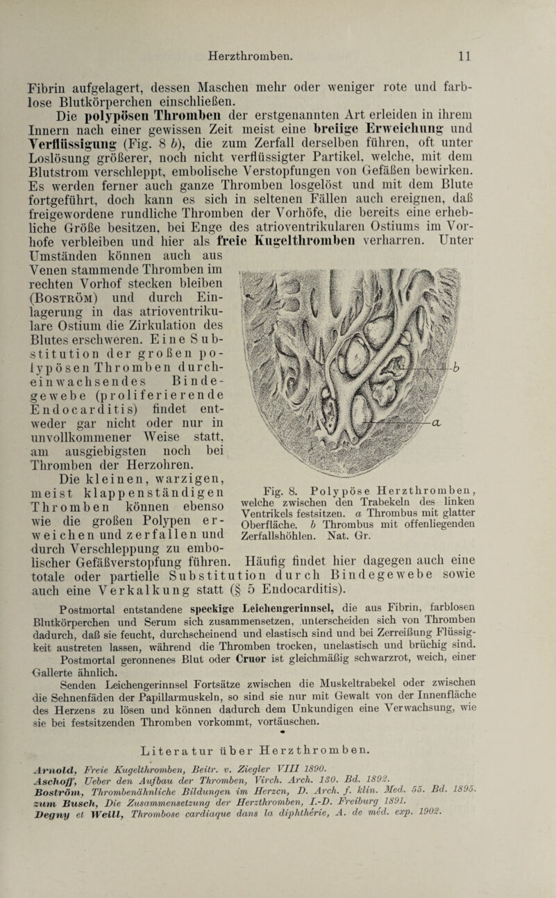 Fibrin aufgelagert, dessen Maschen mehr oder weniger rote und farb¬ lose Blutkörperchen einschließen. Die polypösen Thromben der erstgenannten Art erleiden in ihrem Innern nach* einer gewissen Zeit meist eine breiige Erweichung und Verflüssigung (Fig. 8 b), die zum Zerfall derselben führen, oft unter Loslösung größerer, noch nicht verflüssigter Partikel, welche, mit dem Blutstrom verschleppt, embolische Verstopfungen von Gefäßen bewirken. Es werden ferner auch ganze Thromben losgelöst und mit dem Blute fortgeführt, doch kann es sich in seltenen Fällen auch ereignen, daß freigewordene rundliche Thromben der Vorhöfe, die bereits eine erheb¬ liche Größe besitzen, bei Enge des atrioventrikularen Ostiums im Vor¬ hofe verbleiben und hier als freie Kugelthromben verharren. Unter Umständen können auch aus Venen stammende Thromben im rechten Vorhof stecken bleiben (Boström) und durch Ein¬ lagerung in das atrioventriku¬ lare Ostium die Zirkulation des Blutes erschweren. Eine Sub¬ stitution der großen po¬ lypösen Thromben durch¬ einwachsendes Binde¬ gewebe (proliferierende Endocarditis) findet ent¬ weder gar nicht oder nur in unvollkommener Weise statt, am ausgiebigsten noch bei Thromben der Herzohren. Die kleinen, warzigen, meist klappenständigen Thromben können ebenso wie die großen Polypen er¬ weichen und zerfallen und durch Verschleppung zu embo- lischer Gefäßverstopfung führen. Häutig findet hier dagegen auch eine totale oder partielle Substitution durch Bindegewebe sowie auch eine Verkalkung statt (§ 5 Endocarditis). Postmortal entstandene speckige Leiehengeriimsel, die aus Fibrin, farblosen Blutkörperchen und Serum sich zusammensetzen, unterscheiden sich von Thromben dadurch, daß sie feucht, durchscheinend und elastisch sind und bei Zerreißung Flüssig¬ keit austreten lassen, während die Thromben trocken, unelastisch und brüchig sind. Postmortal geronnenes Blut oder Ouor ist gleichmäßig schwarzrot, weich, einer Gallerte ähnlich. Senden Leichengerinnsel Fortsätze zwischen die Muskeltrabekel oder zwischen die Sehnenfäden der Papillarmuskeln, so sind sie nur mit Gewalt von der Innenfläche des Herzens zu lösen und können dadurch dem Unkundigen eine Verwachsung, wie sie bei festsitzenden Thromben vorkommt, vortäuschen. Literatur über Herz thr om b en. Arnold, Freie Kugelthromben, Beitr. v. Ziegler VIII 1890. Aschoff, Ueber den Aufbau der Thromben, Virch. Arch. ISO. Bd. 1892. Boström, Thrombenähnliche Bildungen im Herzen, D. Arch. f. Min. Med. 55. Bd. 1895. zum Busch, Die Zusammensetzung der Herzthromben, I.-D. Freiburg, 1891. Degny et Weill, Thrombose cardiaque dans la diphtherie, A. de med. exp. 1902. Fig. 8. Polypöse Herzthromben, welche zwischen den Trabekeln des linken Ventrikels festsitzen, a Thrombus mit glatter Oberfläche, b Thrombus mit offenliegenden Zerfallshöhlen. Nat. Gr.