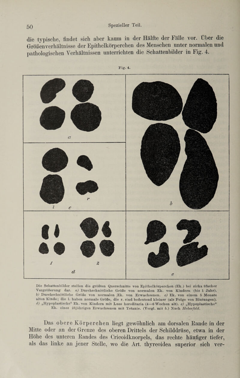 die typische, findet sich aber kaum in der Hälfte der Fälle vor. Über die Größenverhältnisse der Epithelkörperchen des Menschen unter normalen und pathologischen Verhältnissen unterrichten die Schattenbilder in Fig. 4. Fig. 4. a fj c 1 Z d e Die Schattenbilder stellen die größten Querschnitte von Epithelkörperchen (Ek.) bei zirka 8facher Vergrößerung dar. a) Durchschnittliche Größe von normalen Ek. von Kindern (bis 1 Jahr). b) Durchschnittliche Größe von normalen ,Ek. von Erwachsenen, c) Ek. von einem 5 Monate alten Kinde; die 1. haben normale Größe, die r. sind bedeutend kleiner (als Folge von Blutungen). d) „Hypoplastische“ Ek. von Kindern mit Lues hereditaria (4—6 Wochen alt), e) „Hypoplastische“ Ek. eines 25jährigen Erwachsenen mit Tetanie. (Vergl. mit b.) Nach Haberfeld. Das obere Körperchen liegt gewöhnlich am dorsalen Rande in der Mitte oder an der Grenze des oberen Drittels der Schilddrüse, etwa in der Höhe des unteren Randes des Cricoidknorpels, das rechte häufiger tiefer, als das linke an jener Stelle, wo die Art. thyreoidea superior sich ver-