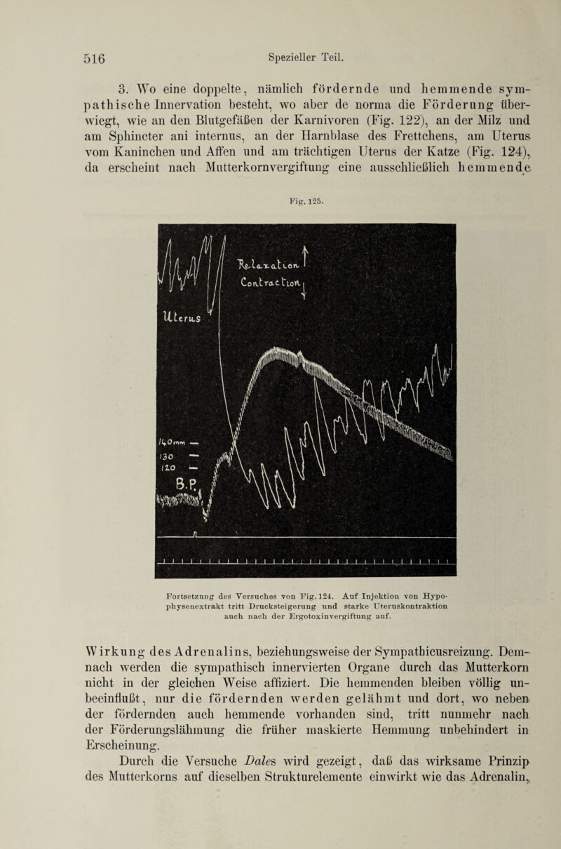 3. Wo eine doppelte, nämlich fördernde und hemmende sym¬ pathische Innervation besteht, wo aber de norma die Förderung über¬ wiegt, wie an den Blutgefäßen der Karnivoren (Fig. 122), an der Milz und am Sphincter ani internus, an der Harnblase des Frettchens, am Uterus vom Kaninchen und Affen und am trächtigen Uterus der Katze (Fig. 124)* da erscheint nach Mutterkornvergiftung eine ausschließlich hemmende Fig.125. Fortsetzung des Versuches von Fig. 124. Auf Injektion von Hypo- physeuextrakt tritt Drucksteigerung und starke Uteruskontraktion auch nach der Ergotoxinvergiftung auf. Wirkung des Adrenalins, beziehungsweise der Sympathicusreizung. Dem¬ nach werden die sympathisch innervierten Organe durch das Mutterkorn nicht in der gleichen Weise affiziert. Die hemmenden bleiben völlig un¬ beeinflußt, nur die fördernden werden gelähmt und dort, wo neben der fördernden auch hemmende vorhanden sind, tritt nunmehr nach der Förderungslähmung die früher maskierte Hemmung unbehindert in Erscheinung. Durch die Versuche Dales wird gezeigt, daß das wirksame Prinzip des Mutterkorns auf dieselben Strukturelemente einwirkt wie das Adrenalin*