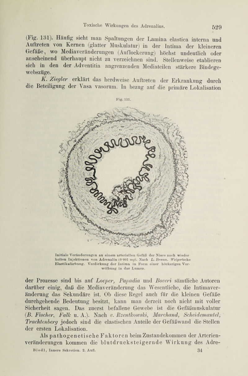 i&* H31). Häufig sieht man Spaltungen der Lamina elastica interna und Auftreten von Kernen (glatter Muskulatur) in der Intima der kleineren Gefäße, wo Mediaveränderungen (Auflockerung) höchst undeutlich oder anscheinend überhaupt nicht zu verzeichnen sind. Stellenweise etablieren sich in den der Adventitia angrenzenden Mediateilen stärkere Bindege- webszüge. K. Ziegler erklärt das herdweise Auftreten der Erkrankung durch die Beteiligung der Vasa vasorum. In bezug auf die primäre Lokalisation Fig.131. Initiale Veränderungen an einem arteriellen Gefäß der Niere nach wieder holten Injektionen von Adrenalin (O'OOl mg). Nach L. Braun. Weigertsche Elastikafärbung. Verdickung der Intima in Form einer höckerigen Vor¬ wölbung in das Lumen. der Prozesse sind bis auf Loeper, Papadia und Boveri sämtliche Autoren darüber einig, daß die Mediaveränderung das Wesentliche, die Intimaver¬ änderung das Sekundäre ist. Ob diese Regel auch für die kleinen Gefäße durchgehende Bedeutung besitzt, kann man derzeit noch nicht mit voller Sicherheit sagen. Das zuerst befallene Gewebe ist die Gefäßmuskulatur (B. Fischer, Fcdk u. A.). Nach v. Rzentkowski, Marchand, Scheidemantel) Trachtenberg jedoch sind die elastischen Anteile der Gefäßwand die Stellen der ersten Lokalisation. Als pathogenetische Faktoren beim Zustandekommen der Arterien¬ veränderungen kommen die blutdrucksteigernde Wirkung des Adre- Biedl, Innere Sekretion. 2. Aufl. 34