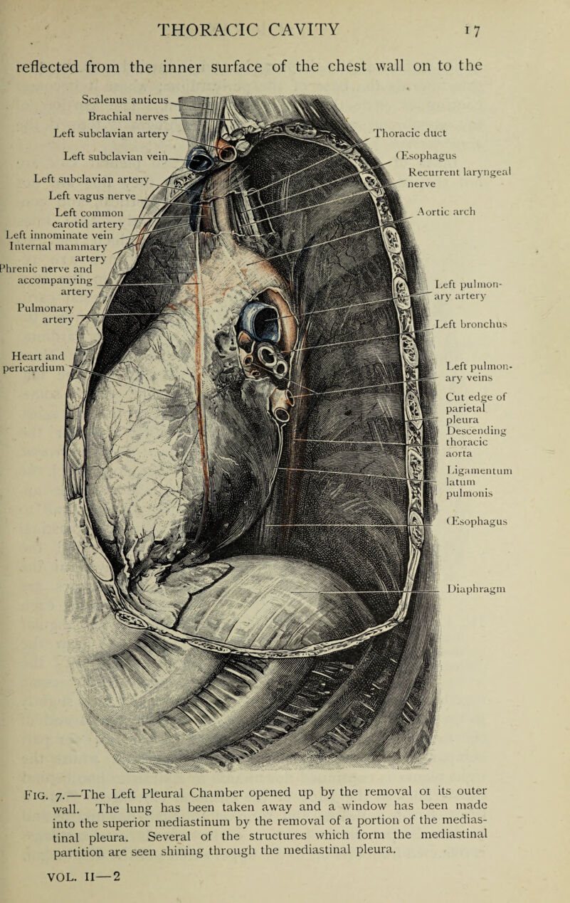 reflected from the inner surface of the chest wall on to the Scalenus anticus Brachial nerves Left subclavian artery Left subclavian Left subclavian artery Left vagus nerve Left common carotid artery Left innominate vein Internal mammary artery 3hrenic nerve and accompanying artery Pulmonary artery Heart and pericardium Left pulmon¬ ary veins Cut edge of parietal pleura Descending thoracic aorta Ligamentum latum pulmonis (Esophagus Diaphragm Aortic arch pulmon¬ ary artery Left bronchus Thoracic duct (Esophagus Recurrent laryngeal nerve Fig. 7. The Left Pleural Chamber opened up by the removal 01 its outer wall. The lung has been taken away and a window has been made into the superior mediastinum by the removal of a portion of the medias¬ tinal pleura. Several of the structures which form the mediastinal partition are seen shining through the mediastinal pleura. VOL. II—2