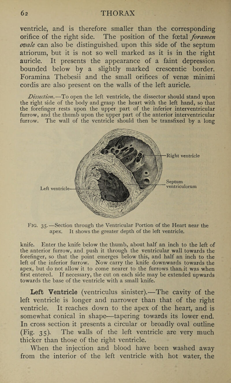 ventricle, and is therefore smaller than the corresponding orifice of the right side. The position of the foetal foramen ovale can also be distinguished upon this side of the septum atriorum, but it is not so well marked as it is in the right auricle. It presents the appearance of a faint depression bounded below by a slightly marked crescentic border. Foramina Thebesii and the small orifices of venae minimi cordis are also present on the walls of the left auricle. Dissection.—To open the left ventricle, the dissector should stand upon the right side of the body and grasp the heart with the left hand, so that the forefinger rests upon the upper part of the inferior interventricular furrow, and the thumb upon the upper part of the anterior interventricular furrow. The wall of the ventricle should then be transfixed by a long Right ventricle Septum ventriculorum Fig. 35.—Section through the Ventricular Portion of the Heart near the apex. It shows the greater depth of the left ventricle. knife. Enter the knife below the thumb, about half an inch to the left of the anterior furrow, and push it through the ventricular wall towards the forefinger, so that the point emerges below this, and half an inch to the left of the inferior furrow. Now carry the knife downwards towards the apex, but do not allow it to come nearer to the furrows than it was when first entered. If necessary, the cut on each side may be extended upwards towards the base of the ventricle with a small knife. Left Ventricle (ventriculus sinister).—The cavity of the left ventricle is longer and narrower than that of the right ventricle. It reaches down to the apex of the heart, and is somewhat conical in shape—tapering towards its lower end. In cross section it presents a circular or broadly oval outline (Fig. 35). The walls of the left ventricle are very much thicker than those of the right ventricle. When the injection and blood have been washed away from the interior of the left ventricle with hot water, the