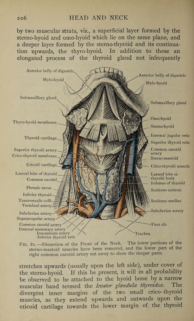 by two muscular strata, viz., a superficial layer formed by the sterno-hyoid and omo-hyoid which lie on the same plane, and a deeper layer formed by the sterno-thyroid and its continua¬ tion upwards, the thyro-hyoid. In addition to these an elongated process of the thyroid gland not infrequently Anterior belly of digastric Mylo-hyoid 1 1 \ Submaxillary gland Thyro-hyoid membrane Anterior belly of digastric Mylo-hyoid Submaxillary gland Thyroid cartilage Superior thyroid artery Crico-thyroid membrane Cricoid cartilage Lateral lobe of thyroid Common carotid Omo-hyoid Sterno-hyoid Internal jugular vein Superior thyroid vein Common carotid artery Sterno-mastoid Crico-thyroid muscle Lateral lobe or thyroid body Isthmus of thyroid Scalenus anticus Scalenus medius ubclavian artery First rib Trachea Phrenic nerve Inferior thyroid Transversalis coll' Vertebral artery Subclavian artery Suprascapular artery Common carotid artery Internal mammary arte Innominate artery Inferior thyroid vein Fig. 81.—Dissection of the Front of the Neck. The lower portions of the sterno-mastoid muscles have been removed, and the lower part of the right common carotid artery cut away to show the deepei parts. stretches upwards (usually upon the left side), under cover of the sterno-hyoid. If this be present, it will in all probability be observed to be attached to the hyoid bone by a narrow muscular band termed the levator gla7idulez thyroidece. The divergent inner margins of the two small crico-thyroid muscles, as they extend upwards and outwards upon the cricoid cartilage towards the lower margin of the thyroid