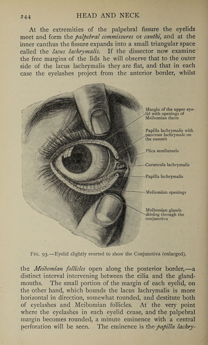 At the extremities of the palpebral fissure the eyelids meet and form the palpebral commissures or canthi, and at the inner canthus the fissure expands into a small triangular space called the lacus lachrymalis. If the dissector now examine the free margins of the lids he will observe that to the outer side of the lacus lachrymalis they are flat, and that in each case the eyelashes project from the anterior border, whilst Fig. 93.—Eyelid slightly everted to show the Conjunctiva (enlarged). Margin of the upper eye- with openings of Meibomian ducts Papilla lachrymalis with punctual lachrymale on the summit Plica semilunaris lachrymalis Papilla lachrymalis Meibomian openings Meibomian glands through the conjunctiva the Meibomian follicles open along the posterior border,—a distinct interval intervening between the cilia and the gland- mouths. The small portion of the margin of each eyelid, on the other hand, which bounds the lacus lachrymalis is more horizontal in direction, somewhat rounded, and destitute both of eyelashes and Meibomian follicles. At the very point where the eyelashes in each eyelid cease, and the palpebral margin becomes rounded, a minute eminence with a central perforation will be seen. The eminence is the papilla lachry-