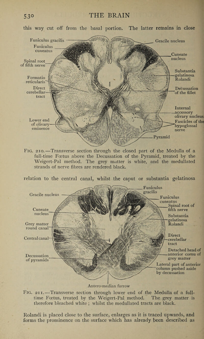 this way cut off from the basal portion. The latter remains in close Gracile nucleus Cuneate nucleus Funiculus gracilis Funiculus cuneatus Spinal root of fifth nerve Lower end of ol eminence Substantia elatinosa i Decussation the fillet Formatio reticularis Direct cerebellar tract Internal accessory olivary nucleus Fascicles of the nerve Pyramid Fig. 2io.—Transverse section through the closed part of the Medulla of a full-time Foetus above the Decussation of the Pyramid, treated by the Weigert-Pal method. The grey matter is white, and the medullated strands of nerve fibres are rendered black. relation to the central canal, whilst the caput or substantia gelatinosa Gracile nucleus Cuneate />•'•' nucleus Grey matter round canal Central canal Decussation of pyramids Funiculus gracilis Funiculus cuneatus Sninal root of fifth nerve Substantia gelatinosa Rolandi Direct cerebellar tract Detached head of anterior cornu of grey matter Lateral part of anterior column pushed aside by decussation Antero-median furrow Fig. 21 i.—Transverse section through lower end of the Medulla of a full¬ time Foetus, treated by the Weigert-Pal method. The grey matter is therefore bleached white ; whilst the medullated tracts are black. Rolandi is placed close to the surface, enlarges as it is traced upwards, and forms the prominence on the surface which has already been described as