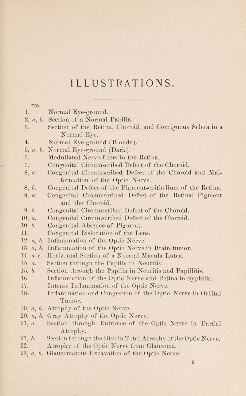 I LLUSTRATIONS. * FIG. 1. 2. a, b. 3. 4. 5. a, 6. 6. 7, 8, a. 8, 6. 9, a. 9, 5. 10, a. 10, 6. 11. 12, a, 6. 13, a, 14, a—c. 15, a. 15, b. 16. 17. 18. 19, a, 5. 20, a, 6. 21, a. 21, 6. 22, 23, a, 6. Normal Eye-ground. Section of a Normal Papilla. Section of the Retina, Choroid, and Contiguous Sclera in a Normal Eye. Normal Eye-ground (Blonde). Normal Eye-ground (Dark). Medullated Nerve-libers in the Retina. Congenital Circumscribed Defect of the Choroid. Congenital Circumscribed Defect of the Choroid and Mal¬ formation of the Optic Nerve. Congenital Defect of the Pigment-epithelium of the Retina. Congenital Circumscribed Defect of the Retinal Pigment and the Choroid. Congenital Circumscribed Defect of the Choroid. Congenital Circumscribed Defect of the Choroid. Congenital Absence of Pigment. Congenital Dislocation of the Lens. Inflammation of the Optic Nerve. Inflammation of the Optic Nerve in Brain-tumor. Horizontal Section of a Normal Macula Lutea. Section through the Papilla in Neuritis. Section through the Papilla in Neuritis and Papillitis. Inflammation of the Optic Nerve and Retina in Syphilis. Intense Inflammation of the Optic Nerve. Inflammation and Congestion of the Optic Nerve in Orbital Tumor. Atrophy of the Optic Nerve. Gray Atrophy of the Optic Nerve. Section through Entrance of the Optic Nerve in Partial Atrophy. Section through the Disk in Total Atrophy of the Optic Nerve. Atrophy of the Optic Nerve from Glaucoma. Glaucomatous Excavation of the Optic Nerve.