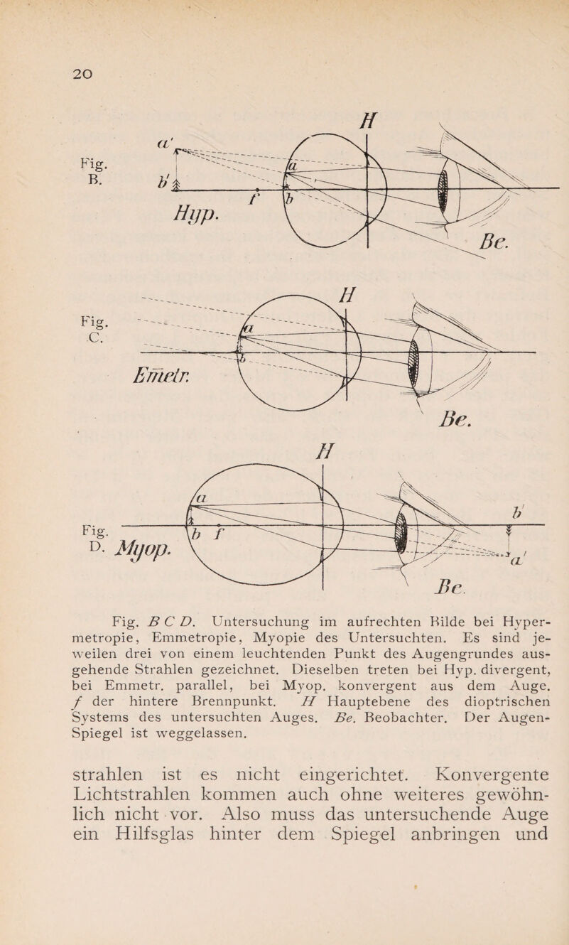 // Fig. B C D. Untersuchung im aufrechten Rüde bei Hvper- metropie, Emmetropie, Myopie des Untersuchten. Es sind je¬ weilen drei von einem leuchtenden Punkt des Augengrundes aus¬ gehende Strahlen gezeichnet. Dieselben treten bei Hvp. divergent, bei Emmetr. parallel, bei Myop, konvergent aus dem Auge. f der hintere Brennpunkt. H Hauptebene des dioptrischen Systems des untersuchten Auges. Be. Beobachter. Der Augen¬ spiegel ist weggelassen. strahlen ist es nicht eingerichtet. Konvergente Lichtstrahlen kommen auch ohne weiteres gewöhn¬ lich nicht vor. Also muss das untersuchende Auge ein Hilfsglas hinter dem Spiegel anbringen und
