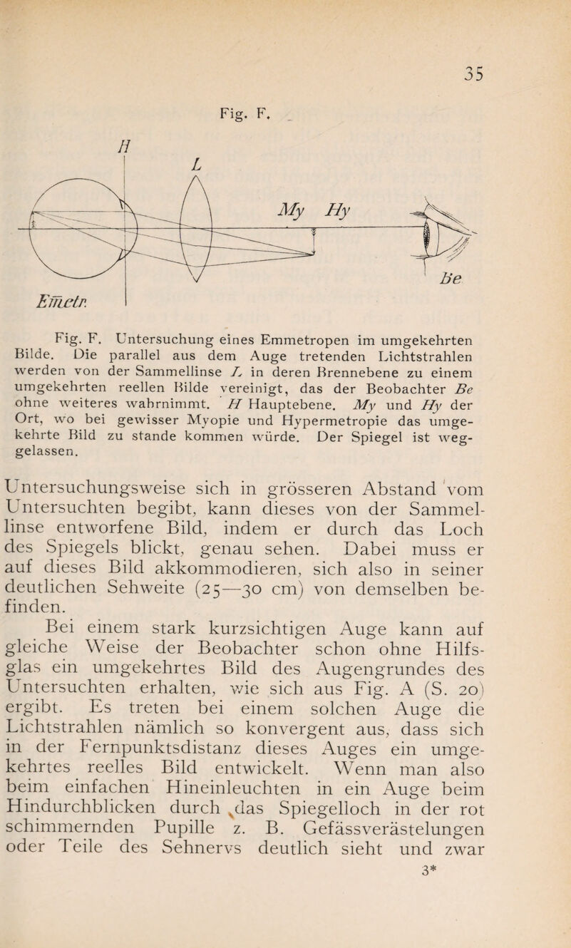 Fig. F. H Fig. F. Untersuchung eines Emmetropen im umgekehrten Bilde. Die parallel aus dem Auge tretenden Lichtstrahlen werden von der Sammellinse A in deren Brennebene zu einem umgekehrten reellen Bilde vereinigt, das der Beobachter Be ohne weiteres wahrnimmt. H Hauptebene. My und Hy der Ort, wo bei gewisser Myopie und Hypermetropie das umge¬ kehrte Bild zu stände kommen würde. Der Spiegel ist weg¬ gelassen. Lntersuchungsweise sich in grösseren Abstand vom Untersuchten begibt, kann dieses von der Sammel¬ linse entworfene Bild, indem er durch das Loch des Spiegels blickt, genau sehen. Dabei muss er auf dieses Bild akkommodieren, sich also in seiner deutlichen Sehweite (25—30 cm) von demselben be¬ finden. Bei einem stark kurzsichtigen Auge kann auf gleiche Weise der Beobachter schon ohne Hilfs¬ glas ein umgekehrtes Bild des Augengrundes des Untersuchten erhalten, wie sich aus Fig. A (S. 20) ergibt. Es treten bei einem solchen Auge die Lichtstrahlen nämlich so konvergent aus, dass sich in der t ernpunktsdistanz dieses Auges ein umge¬ kehrtes reelles Bild entwickelt. Wenn man also beim einfachen Hineinleuchten in ein Auge beim Hindurchblicken durch ^das Spiegelloch in der rot schimmernden Pupille z. B. Gefässverästelungen oder Teile des Sehnervs deutlich sieht und zwar 3*