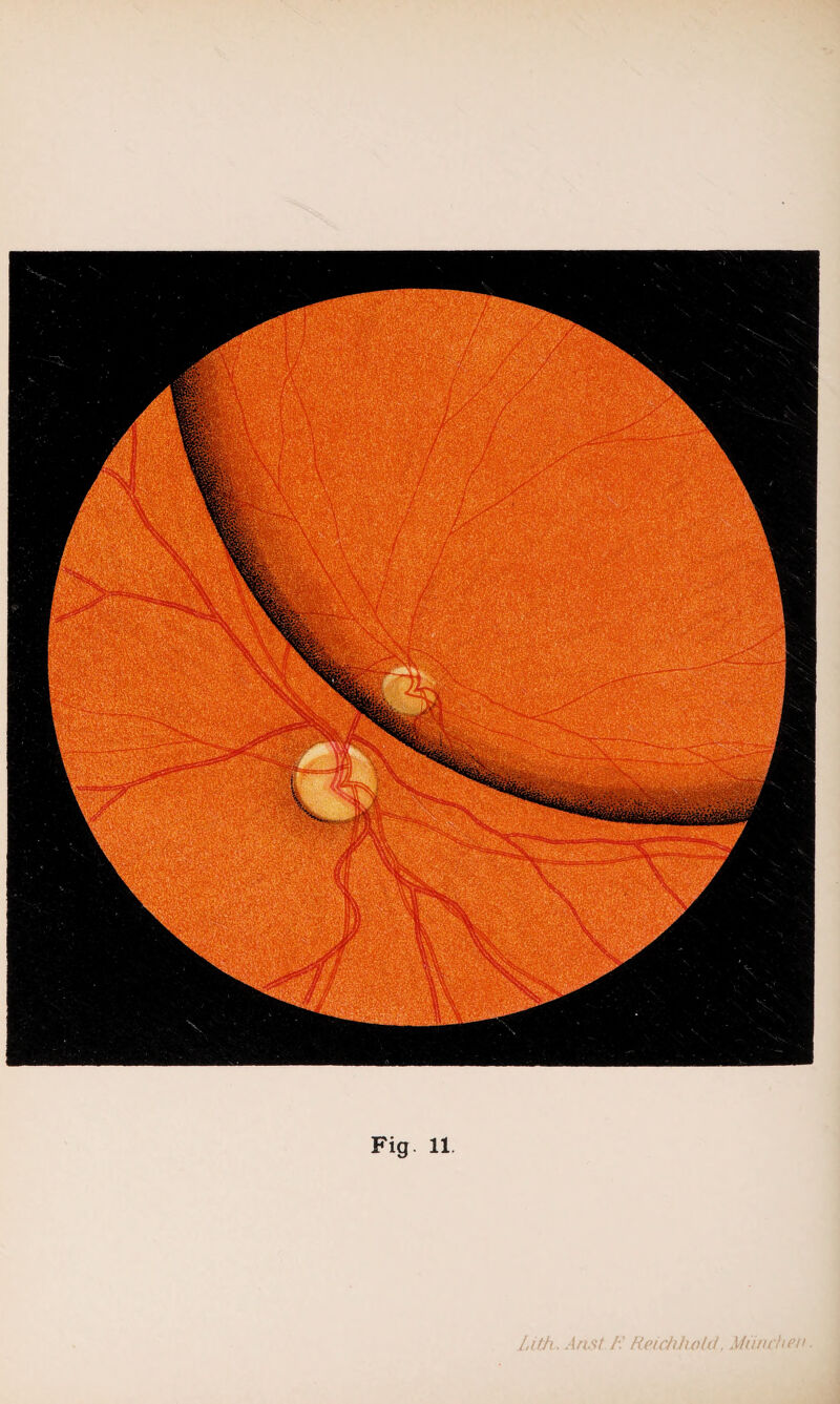 Fig. 11. t /:' RpichhoUi, München