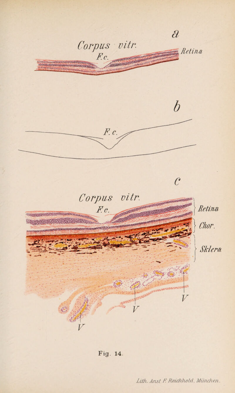 Corpus vitr. Retina b v Fig. 14. Lüh. Ans/ F. ReichAold, München.