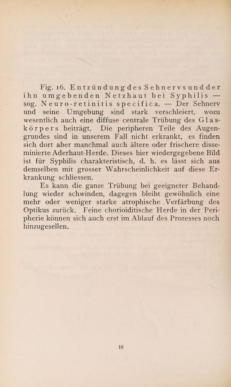 ihn umgebenden Netzhaut bei Syphilis — sog. Neuro-retinitis specifica. — Der Sehnerv und seine Umgebung sind stark verschleiert, wozu wesentlich auch eine diffuse centrale Trübung des Glas¬ körpers beiträgt. Die peripheren Teile des Augen¬ grundes sind in unserem Fall nicht erkrankt, es finden sich dort aber manchmal auch ältere oder frischere disse- minierte Aderhaut-Herde. Dieses hier wiedergegebene Bild ist für Syphilis charakteristisch, d. h. es lässt sich aus demselben mit grosser Wahrscheinlichkeit auf diese Er¬ krankung schliessen. Es kann die ganze Trübung bei geeigneter Behand¬ lung wieder schwinden, dagegen bleibt gewöhnlich eine mehr oder weniger starke atrophische Verfärbung des Optikus zurück. Feine chorioiditische Herde in der Peri¬ pherie können sich auch erst im Ablauf des Prozesses noch hinzugesellen. 16
