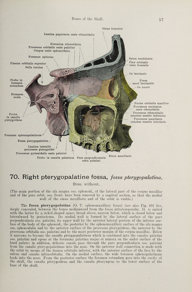 Sinus frontalis Foramen ovale 'v Probe in foramen rotundum Fossa sacci lacrimalis x Os nasale / / / Probe j in canalis - pterygoideus Facies orbitalis maxillae Processus uncinatus ossis ethmoidalis Processus ethmoidalis conchae nasalis inferioris Processus maxillaris conchae nasalis inferioris Foramen sphenopalatinum Fossa pterygopalatina j Lamina lateralis processus pterygoidei Processus pyramidalis ossis palatini Probe in canalis palatinus Lamina papyracea ossis ethmoidalis Foramina ethmoidalia Processus orbitalis ossis palatini | Corpus ossis sphenoidalis • \\ Foramen opticum Fissura orbitalis superior Sella turcica \ Spina trochlearis Pars orbitalis ossis frontalis Os lacrimale i ' , . Sinus maxillaris Pars perpendiculans ossis palatini 70. Right pterygopalatine fossa, fossa pterygopalatina, from without. (The main portion of the ala magna oss. sphenoid., of the lateral part of the corpus maxillae and of the pars orbit, oss. front, have been removed by a sagittal section, so that the medial wall of the sinus maxillaris and of the orbit is visible.) The fossa pterygopalatina (0. T. sphenomaxillary fossa) (see also Fig. 69) lies, deeply concealed, between the bones medianward from the fossa infratemporalis. It is united with the latter by a sickel-shaped space, broad above, narrow below, which is closed below and lateralward by periosteum. Its medial wall is formed by the lateral surface of the pars perpendicularis oss. palatini, its upper wall by the anterior lateral portion of the inferior sur¬ face of the body of the sphenoid., the posterior by the sphenomaxillary surface of the ala magna oss. sphenoidalis and by the anterior surface of the processus pterygoideus, the anterior by the processus orbitalis oss. palatini and by the most posterior margin of the corpus maxillae. Below it narrows to become the canalis pterygopalatinus which is continued into the canales palatini oss. palatini and opens at the foramina palatina majus et minora on the under surface of the hard palate; in addition, delicate canals pass through the pars perpendicularis oss. palatini from the canalis pterygopalatinus into the nose. On the anterior wall connection is made with the orbit by means of the fissura orbitalis inferior, with the anterior surface of the face by the sulcus and canalis infraorbitalis. On the medial surface, the wide foramen sphenopalatinum leads into the nose. From the posterior surface the foramen rotundum goes into the cavity of the skull, the canalis pterygoideus and the canalis pharyngeus to the lower surface of the base of the skull.