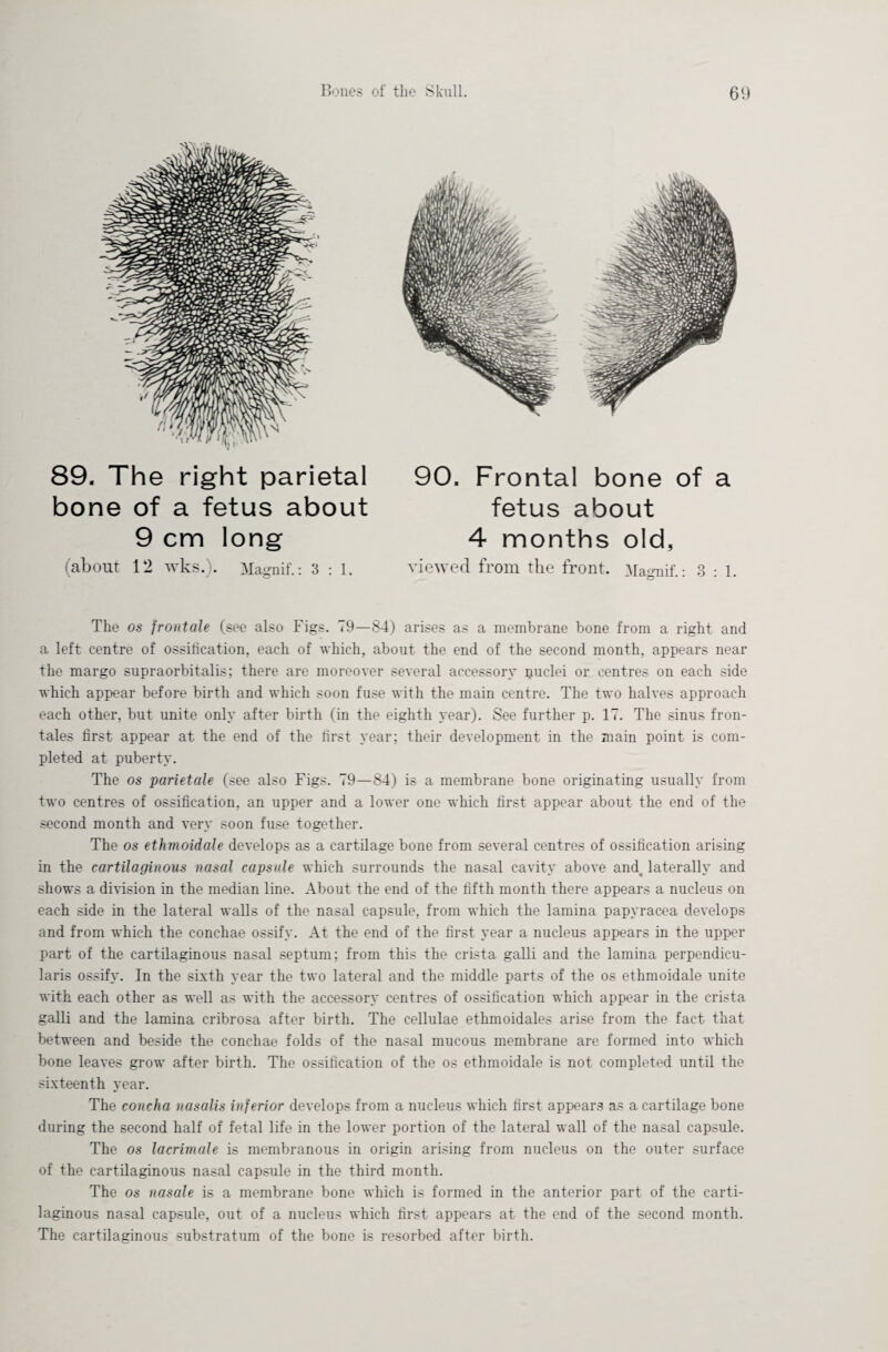 89. The right parietal bone of a fetus about 9 cm long (about 12 wks.). Magnif.: 3:1. 90. Frontal bone of a fetus about 4 months old, viewed from the front. Magnif • 3 1. o * The os frontale (see also Figs. 79—84) arises as a membrane bone from a right and a left centre of ossification, each of which, about the end of the second month, appears near the margo supraorbitalis; there are moreover several accessory puclei or centres on each side which appear before birth and which soon fuse with the main centre. The two halves approach each other, but unite only after birth (in the eighth year). See further p. 17. The sinus fron¬ tales first appear at the end of the first year; their development in the main point is com¬ pleted at puberty. The os parietale (see also Figs. 79—84) is a membrane bone originating usually from two centres of ossification, an upper and a lower one which first appear about the end of the second month and very soon fuse together. The os ethmoidale develops as a cartilage bone from several centres of ossification arising in the cartilaginous nasal capsule which surrounds the nasal cavity above ami laterally and shows a division in the median line. About the end of the fifth month there appears a nucleus on each side in the lateral walls of the nasal capsule, from which the lamina papyracea develops and from which the conehae ossify. At the end of the first year a nucleus appears in the upper part of the cartilaginous nasal septum; from this the crista galli and the lamina perpendicu- laris ossify. In the sixth year the two lateral and the middle parts of the os ethmoidale unite with each other as well as with the accessory centres of ossification which appear in the crista galli and the lamina cribrosa after birth. The cellulae ethmoidales arise from the fact that between and beside the conchae folds of the nasal mucous membrane are formed into which bone leaves grow after birth. The ossification of the os ethmoidale is not completed until the sixteenth year. The concha nasalis inferior develops from a nucleus which first appears as a cartilage bone during the second half of fetal life in the lower portion of the lateral wall of the nasal capsule. The os lacrimale is membranous in origin arising from nucleus on the outer surface of the cartilaginous nasal capsule in the third month. The os nasale is a membrane bone which is formed in the anterior part of the carti¬ laginous nasal capsule, out of a nucleus which first appears at the end of the second month. The cartilaginous substratum of the bone is resorbed after birth.