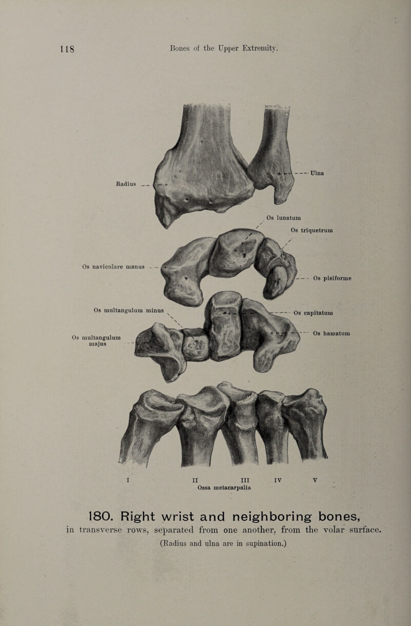 Radius_ Os lunatum Os triquetrum Os pisiforme Os capitatum Os hamatum Os naviculare manus — Os multangulum minus Os multangulum majus -Ulna I II III IV V Ossa metacarpalia 180. Right wrist and neighboring bones, in transverse rows, separated from one another, from the volar surface (Radius and ulna are in supination.)