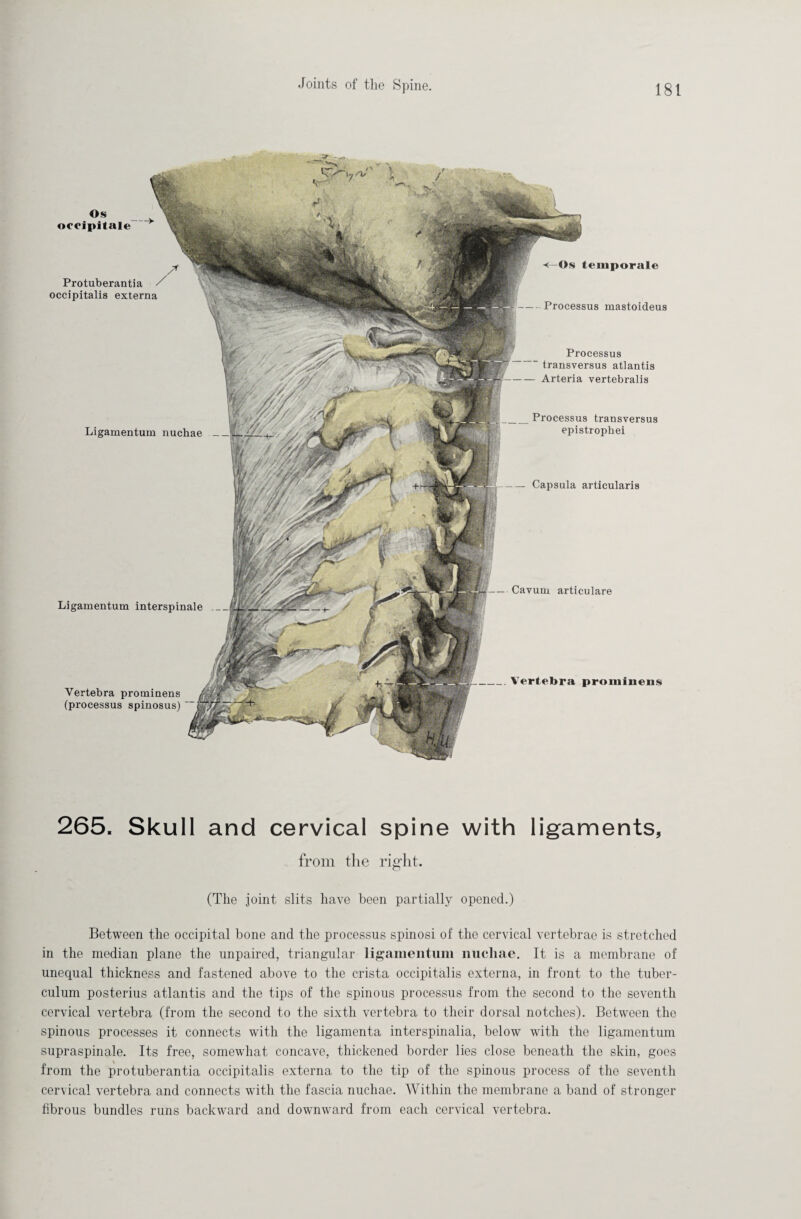 Ligamentum nuchae -Capsula articularis _Vertebra prominens Ligamentum interspinale Vertebra prominens (processus spinosus) “ Os temporale Processus mastoideus Processus transversus atlantis — Arteria vertebralis Processus transversus epistrophei — Cavum articulare Os occipitale —-> Protuberantia / occipitalis externa 265. Skull and cervical spine with ligaments, from the right. (The joint slits have been partially opened.) Between the occipital bone and the processus spinosi of the cervical vertebrae is stretched in the median plane the unpaired, triangular ligamentum nuchae. It is a membrane of unequal thickness and fastened above to the crista occipitalis externa, in front to the tuber- culum posterius atlantis and the tips of the spinous processus from the second to the seventh cervical vertebra (from the second to the sixth vertebra to their dorsal notches). Between the spinous processes it connects with the ligamenta interspinalia, below with the ligamentum supraspinale. Its free, somewhat concave, thickened border lies close beneath the skin, goes from the protuberantia occipitalis externa to the tip of the spinous process of the seventh cervical vertebra and connects with the fascia nuchae. Within the membrane a band of stronger fibrous bundles runs backward and downward from each cervical vertebra.