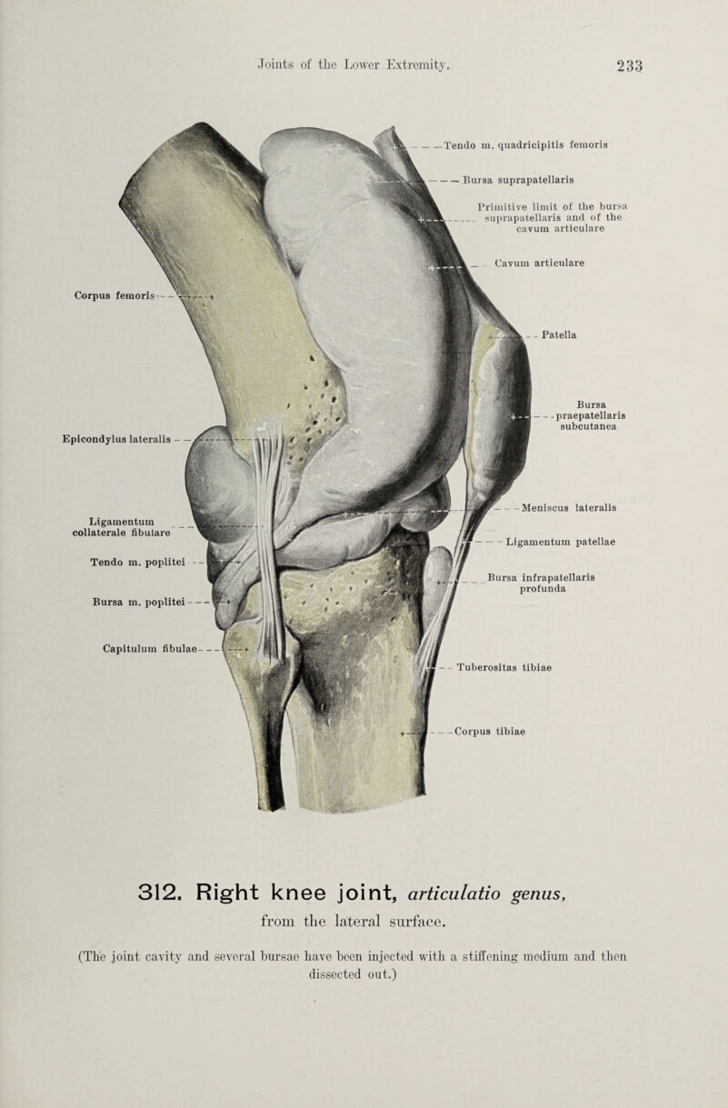 Corpus femoris- Epicondylus lateralis - - - Patella Bursa -praepatellaris subcutanea -Meniscus lateralis -Ligamentum patellae Bursa infrapatellaris profunda - - Tuberositas tibiae -Corpus tibiae Ligamentum collaterale fibulare Tendo m. poplitei - Bursa m. poplitei-- Capitulum fibulae -Tendo m. quadricipitis femoris -Bursa suprapatellaris Primitive limit of the bursa _ suprapatellaris and of tbe cavum articulare Cavum articulare 312. Right knee joint, articulatio genus, from the lateral surface. (The joint cavity and several bursae have been injected with a stiffening medium and then dissected out.)