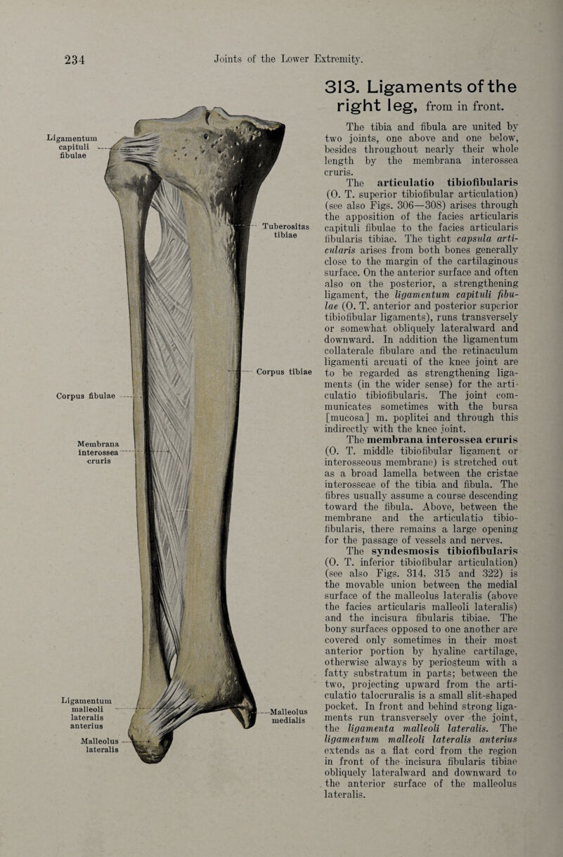 — Malleolus medialis Corpus fibulae Membrana interossea cruris Ligamentum malleoli lateralis anterius Malleolus lateralis Tuberositas tibiae Ligamentum capituli fibulae Corpus tibiae 313. Ligaments of the right leg, from in front. The tibia and fibula are united by two joints, one above and one below, besides throughout nearly their whole length by the membrana interossea cruris. The articulatio tibioflbularis (0. T. superior tibiofibular articulation) (see also Figs. 306—308) arises through the apposition of the facies articularis capituli fibulae to the facies articularis fibularis tibiae. The tight capsula arti¬ cularis arises from both bones generally close to the margin of the cartilaginous surface. On the anterior surface and often also on the posterior, a strengthening ligament, the ligamentum capituli fibu¬ lae (0. T. anterior and posterior superior tibiofibular ligaments), runs transversely or somewhat obliquely lateral ward and downward. In addition the ligamentum collateral fibulare and the retinaculum ligamenti arcuati of the knee joint are to be regarded as strengthening liga¬ ments (in the wider sense) for the arti¬ culatio tibiofibularis. The joint com¬ municates sometimes with the bursa [mucosa] m. poplitei and through this indirectly with the knee joint. The membrana interossea cruris (0. T. middle tibiofibular ligament or interosseous membrane) is stretched out as a broad lamella between the cristae interosseae of the tibia and fibula. The fibres usually assume a course descending toward the fibula. Above, between the membrane and the articulatio tibio¬ fibularis, there remains a large opening for the passage of vessels and nerves. The syndesmosis tibioflbularis (0. T. inferior tibiofibular articulation) (see also Figs. 314, 315 and 322) is the movable union between the medial surface of the malleolus lateralis (above the facies articularis malleoli lateralis) and the incisura fibularis tibiae. The bony surfaces opposed to one another are covered only sometimes in their most anterior portion by hyaline cartilage, otherwise always by periosteum with a fatty substratum in parts; between the two, projecting upward from the arti¬ culatio talocruralis is a small slit-shaped pocket. In front and behind strong liga¬ ments run transversely over the joint, the ligamenta malleoli lateralis. The ligamentum malleoli lateralis anterius extends as a flat cord from the region in front of the incisura fibularis tibiae obliquely lateralward and downward to the anterior surface of the malleolus lateralis.