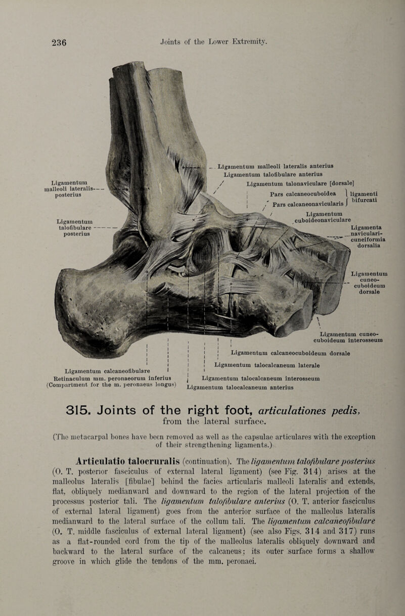 Ligamentum cuneo- cuboideum dorsale Ligamentum malleoli lateralis anterius Ligamentum talofibulare anterius / Ligamentum talonaviculare [dorsale] Pars calcaneocuboidea | ligamenti - . . . [ bifurcati , Pars calcaneonaviculans J / Ligamentum cuboideonaviculare Ligamenta naviculari- cuneiformia dorsalia Ligamentum malleoli lateralis- posterius Ligamentum talofibulare — posterius Ligamentum cuneo- cuboideum interosseum Ligamentum calcaneocuboideum dorsale Ligamentum calcaneofibulare ' Retinaculum mm. peronaeorum inferius (Compartment for the m. peronaeus longus) I i Ligamentum talocalcaneum laterale i i ] Ligamentum talocalcaneum interosseum Ligamentum talocalcaneum anterius 315. Joints of the right foot, articulationes pedis, from the lateral surface. (The metacarpal bones have been removed as well as the capsulae articulares with the exception of their strengthening ligaments.) Articulatio talocruralis (continuation). The ligamentum talofibulare posterius (0. T. posterior fasciculus of external lateral ligament) (see Fig. 314) arises at the malleolus lateralis [fibulae] behind the facies articularis malleoli lateralis and extends, flat, obliquely medianward and downward to the region of the lateral projection of the processus posterior tali. The ligamentum talofibulare anterius (0. T. anterior fasciculus of external lateral ligament) goes from the anterior surface of the malleolus lateralis medianward to the lateral surface of the collum tali. The ligamentum calcaneofbulare (0. T. middle fasciculus of external lateral ligament) (see also Figs. 314 and 317) runs as a fiat-rounded cord from the tip of the malleolus lateralis obliquely downward and backward to the lateral surface of the calcaneus; its outer surface forms a shallow groove in which glide the tendons of the mm. peronaei.