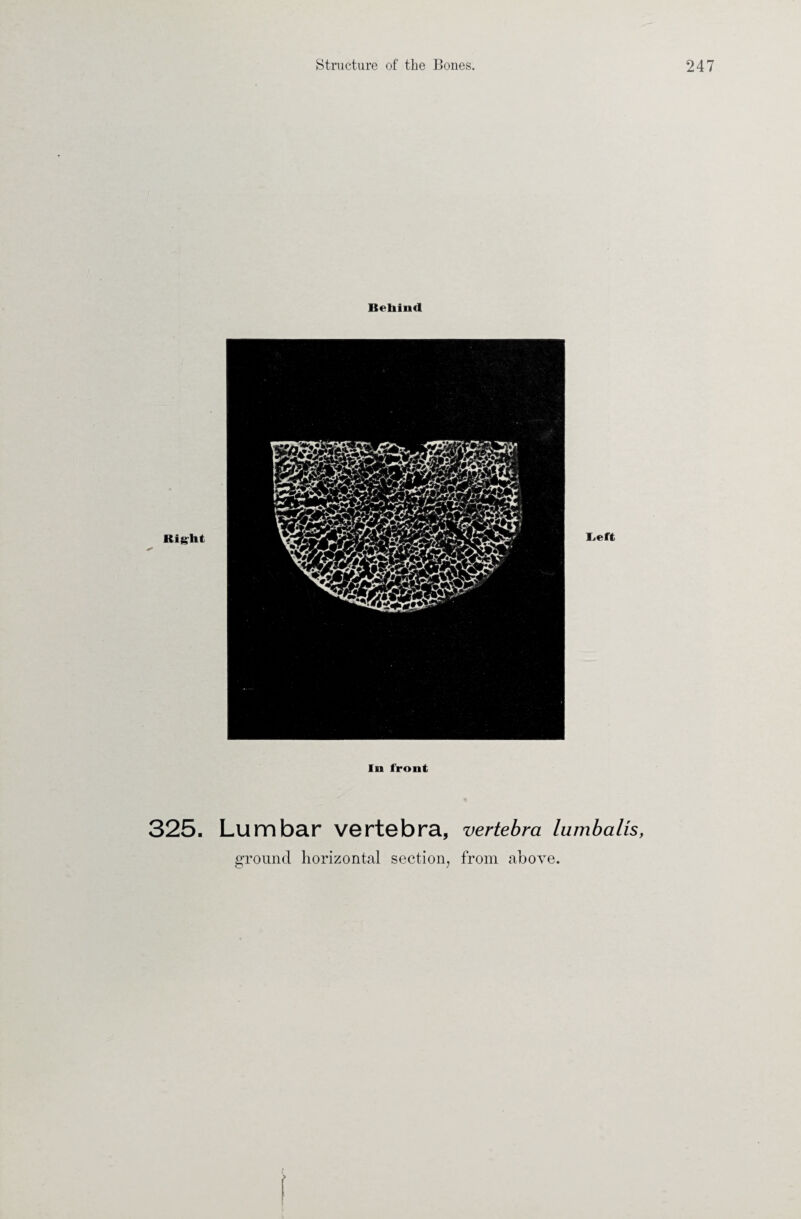 Behind In front 325. Lumbar vertebra, vertebra lumbalts,