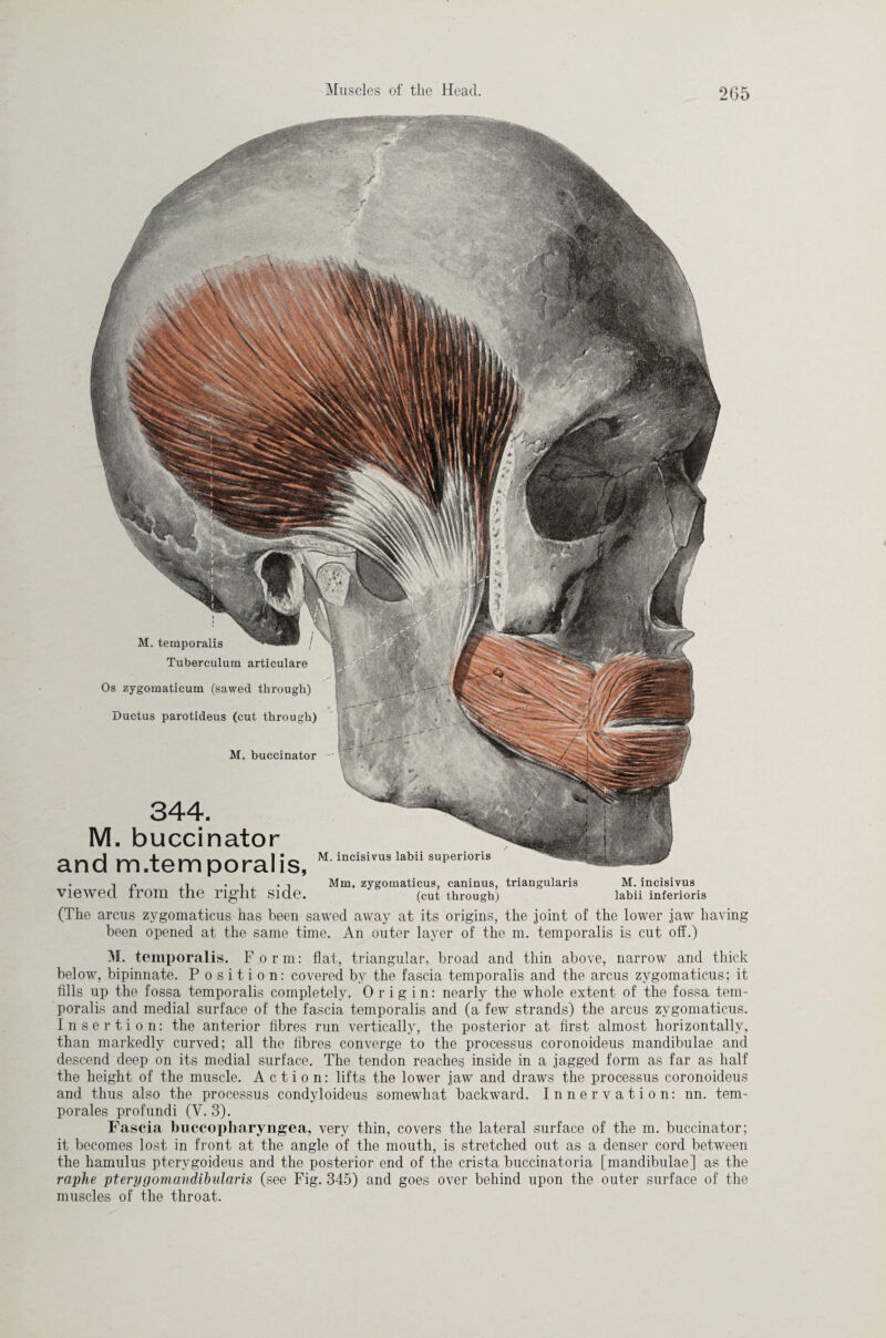 M. temporalis Tuberculum articulare Os zygomaticum (sawed through) Ductus parotideus (cut through) M. buccinator 344. M. buccinator M. incisivus labii superioris and m.temporalis, • -| i i Mm. zygomaticus, caninus, triangularis viewed from the right side. (cut through) (The arcus zygomaticus has been sawed away at its origins, the joint of the lower jaw having been opened at the same time. An outer layer of the m. temporalis is cut off.) M. incisivus labii inferioris M. temporalis. Form: flat, triangular, broad and thin above, narrow and thick below, bipinnate. Position: covered by the fascia temporalis and the arcus zygomaticus; it fills up the fossa temporalis completely. Origin: nearly the whole extent of the fossa tem¬ poralis and medial surface of the fascia temporalis and (a few strands) the arcus zygomaticus. Insertion: the anterior fibres run vertically, the posterior at first almost horizontally, than markedly curved; all the fibres converge to the processus coronoideus mandibulae and descend deep on its medial surface. The tendon reaches inside in a jagged form as far as half the height of the muscle. Action: lifts the lower jaw and draws the processus coronoideus and thus also the processus condyloideus somewhat backward. Innervation: nn. tem¬ porales profundi (Y. 3). Fascia buccopharyngea, very thin, covers the lateral surface of the m. buccinator; it becomes lost in front at the angle of the mouth, is stretched out as a denser cord between the hamulus ptervgoideus and the posterior end of the crista buccinatoria [mandibulae] as the raphe pterygomandibularis (see Fig. 345) and goes over behind upon the outer surface of the muscles of the throat.