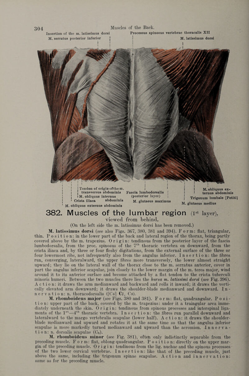 Insertion of the m. latissimus dorsi Processus spinosus vertebrae thoracalis XII M. serratus posterior inferior i i l I I i i I M. latissimus dorsi j Tendon of origin of them. j 1 I j transversus abdominis Fascia lumbodorsalis j i M. obliquus internus (posterior layer) 1 Crista iliaca abdominis m. glutaeus maximus M. obliquus externus abdominis I I M. obliquus ex- 1 teruus abdominis | Trigonum lumbale [Petiti] M. glutaeus medius 382. Muscles of the lumbar region (is* layer), viewed from behind. (On the left side the m. latissimus dorsi has been removed.) M. latissimus dorsi (see also Figs. 367, 380, 381 and 394). Form: flat, triangular, thin. Position: in the lower part of the back and lateral region of the thorax, being partly covered above by the m. trapezius. Origin: tendinous from the posterior layer of the fascia lumbodorsalis, from the proc. spinosus of the 7th thoracic vertebra on downward, from the crista iliaca and, by three or four fleshy digitations, from the external surface of the three or four lowermost ribs, not infrequently also from the angulus inferior. Insertion: the fibres run, converging, lateralward, the upper fibres more transversely, the lower almost straight upward; they lie on the lateral wall of the thorax close to the m. serratus anterior, cover in part the angulus inferior scapulae, join closely to the lower margin of the m. teres major, wind around it to its anterior surface and become attached by a flat tendon to the crista tuberculi minoris humeri. Between the two muscles there lies the bursa m. latissimi dorsi (see Fig. 396). Action: it draws the arm medianward and backward and rolls it inward; it draws the verti¬ cally elevated arm downward; it draws the shoulder-blade medianward and downward. In¬ nervation: n. thoracodorsalis ([Cm] Ct, Cs). M. rliomboideus major (see Figs. 380 and 381). Form: flat, quadrangular. Posi¬ tion: upper part of the back, covered by the m. trapezius: under it a traingular area imme¬ diately underneath the skin. Origin: tendinous from spinous processes and interspinal liga¬ ments of the 1st—4th thoracic vertebra. Insertion: the fibres run parallel downward and lateralward to the margo vertebralis scapulae (lower half). Action: it draws the shoulder- blade medianward and upward and rotates it at the same time so that the angulus inferior scapulae is more markedly turned medianward and upward than the acromion. Innerva¬ tion: n. dorsalis scapulae (Cs). M. rliomboideus minor (see Fig. 381), often only indistinctly separable from the preceding muscle. Form: flat, oblong-quadrangular. Position: directly on the upper mar¬ gin of the preceding muscle. Origin: tendinous from the lig. nuchae and the spinous processes of the two lower cervical vertebrae. Insertion: like that of the preceding muscle, just above the same, including the trigonum spinae scapulae. Action and innervation: same as for the preceding muscle.