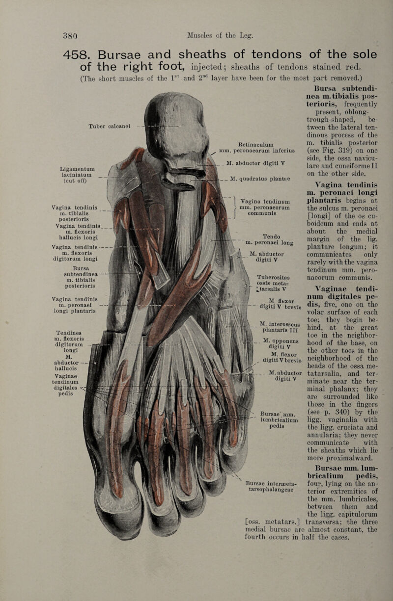 458. Bursae and sheaths of tendons of the sole of the right foot, injected; sheaths of tendons stained red. (The short muscles of the 1st and 2nd layer have been for the most part removed.) Tuber calcanei - Retinaculum mm. peronaeorum inferius _ M. abductor digiti Y _ M. quadratus plantae Vagina tendinum mm. peronaeorum communis Tendo m. peronaei long M. abductor digiti Y Tuberositas ossis meta- ! tarsalis V Bursa subtendi- nea m.tibialis pos¬ terior^, frequently present, oblong- trough-shaped, be¬ tween the lateral ten¬ dinous process of the m. tibialis posterior (see Fig. 319) on one side, the ossa navicu- lare and cuneiforme II on the other side. Vagina tendinis m. peronaei longi plantaris begins at the sulcus m. peronaei [longi] of the os cu- boideum and ends at about the medial margin of the lig. plantare longum; it communicates only rarely with the vagina tendinum mm. pero¬ naeorum communis. Vaginae tendi- num digitales pe¬ dis, five, one on the volar surface of each toe; they begin be¬ hind, at the great toe in the neighbor¬ hood of the base, on the other toes in the neighborhood of the heads of the ossa me- tatarsalia, and ter¬ minate near the ter¬ minal phalanx; they are surrounded like those in the fingers (see p. 340) by the ligg. vaginalia with the ligg. cruciata and annularia; they never communicate with the sheaths which lie more proximalward. Bursae mm. lum- bricalium pedis, four, lying on the an¬ terior extremities of the mm. lumbricales, between them and the ligg. capitulorum [oss. metatars.] transversa; the three medial bursae are almost constant, the fourth occurs in half the cases. M flexor digiti V brevis M. interosseus plantaris HI . M. opponens digiti V M. flexor , digitiVbrevis _ _ M. abductor digiti Y Bursae mm. lumbricaiium pedis Bursae intermeta- tarsopbalangeae Ligamentum laciniatum (cut off) Vagina tendinis m. tibialis posterioris Vagina tendinis m. flexoris hallucis longi Vagina tendinis - m. flexoris digitorum longi Bursa subtendinea m. tibialis posterioris Vagina tendinis m. peronaei longi plantaris Tendines m. flexoris digitorum longi M. abductor — hallucis Vaginae tendinum digitales pedis