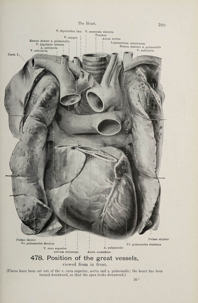 Costa IN \ Pulmo dexter Vv. pulmonales dextrae Y. cava superior l Atrium sinistrum Y. thyreoidea ima V. azygos | .Ramus dexter a. pulmonalis i V. jugularis interna A. subclavia i Y. subclavia V. anonyma sinistra I Trachea I Arcus aortae | j j Ligamentum arteriosum Ramus sinister a. pulmonalis Y. subclavia Pulmo sinister I i Vv. pulmonales sinistrae I A. pulmonalis i Aorta ascendens 478. Position of the great vessels, viewed from in front. (Pieces have been cut out of the v. cava superior, aorta and a. pulmonalis; the heart has been turned downward, so that the apex looks downward.) 26*