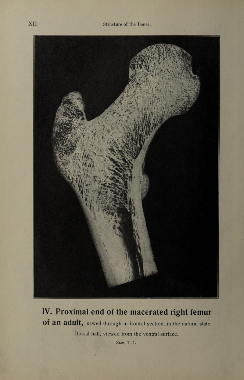 IV. Proximal end of the macerated right femur of an adult, sawed through in frontal section, in the natural state. Dorsal half, viewed from the ventral surface.