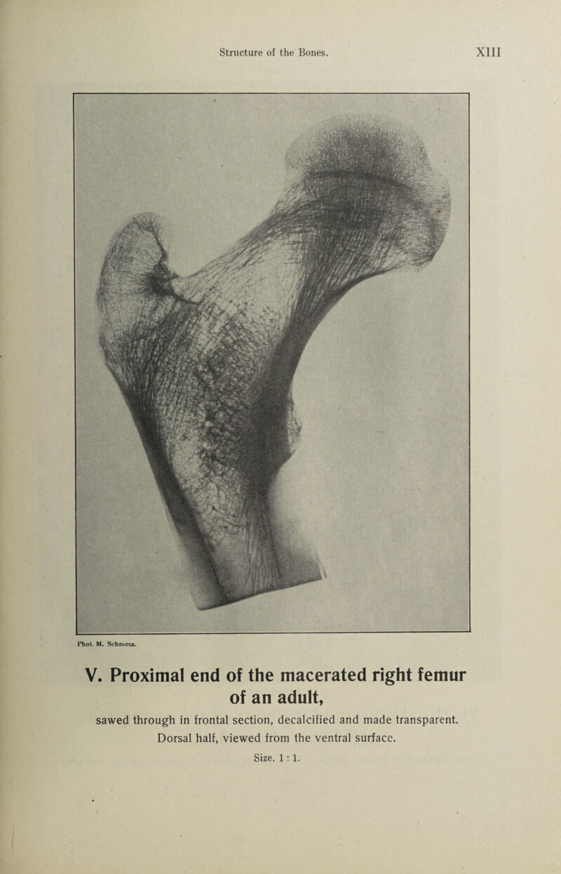 Phot. M. Sehnieiz. V. Proximal end of the macerated right femur of an adult, sawed through in frontal section, decalcified and made transparent. Dorsal half, viewed from the ventral surface.