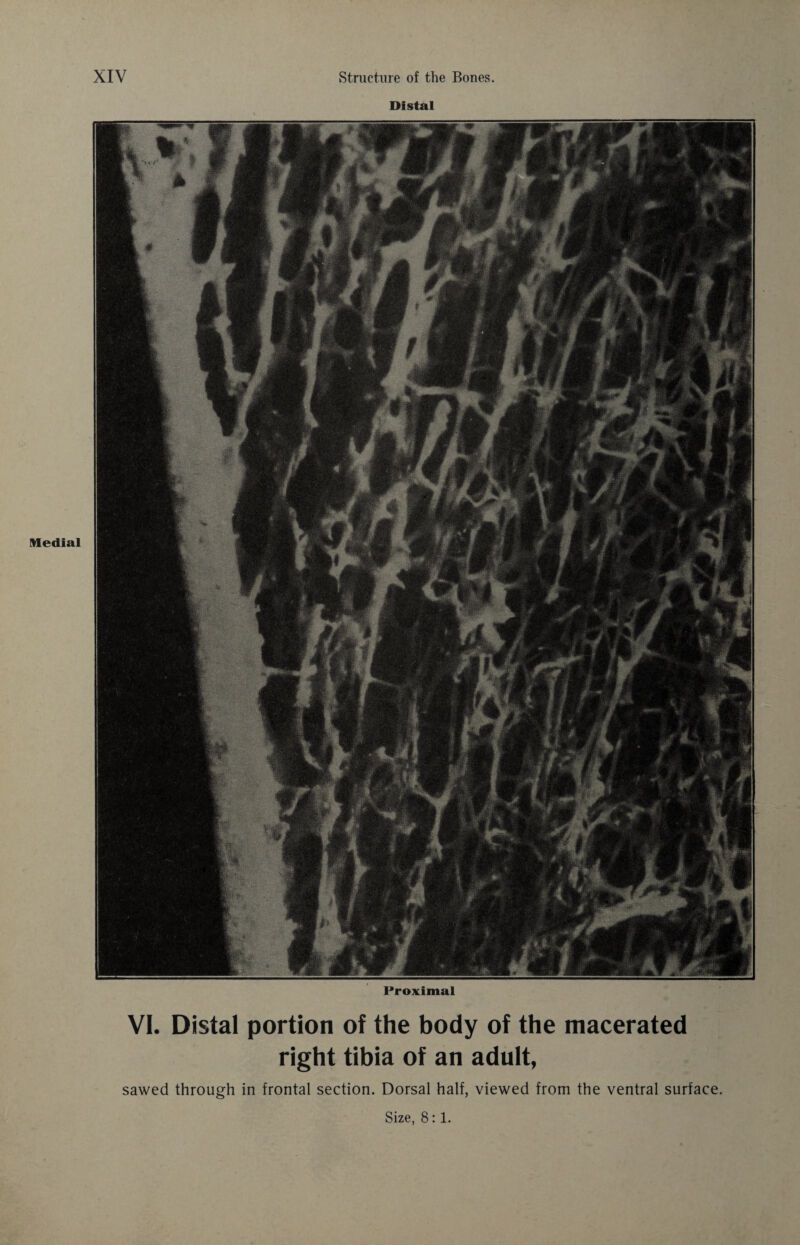 Medial Distal Proximal VI. Distal portion of the body of the macerated right tibia of an adult, sawed through in frontal section. Dorsal half, viewed from the ventral surface.