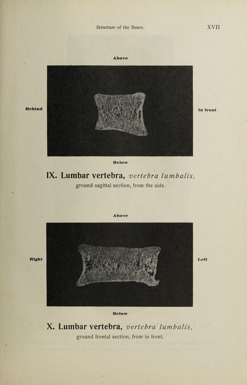 Behind Right Above Below IX. Lumbar vertebra, vertebra lumbalis, ground sagittal section, from the side. Above Below In front Left X. Lumbar vertebra, vertebra lumbalis,