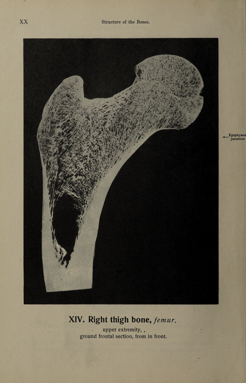 ,w* - . *• - * 1 .f* *i ■ • *** > . : V#1*’' ■' **zr'i2- .V * '•<«* Epiphysea junction XIV. Right thigh bone, femur, upper extremity, .