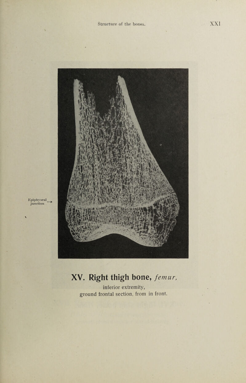 XV. Right thigh bone, femur, inferior extremity,