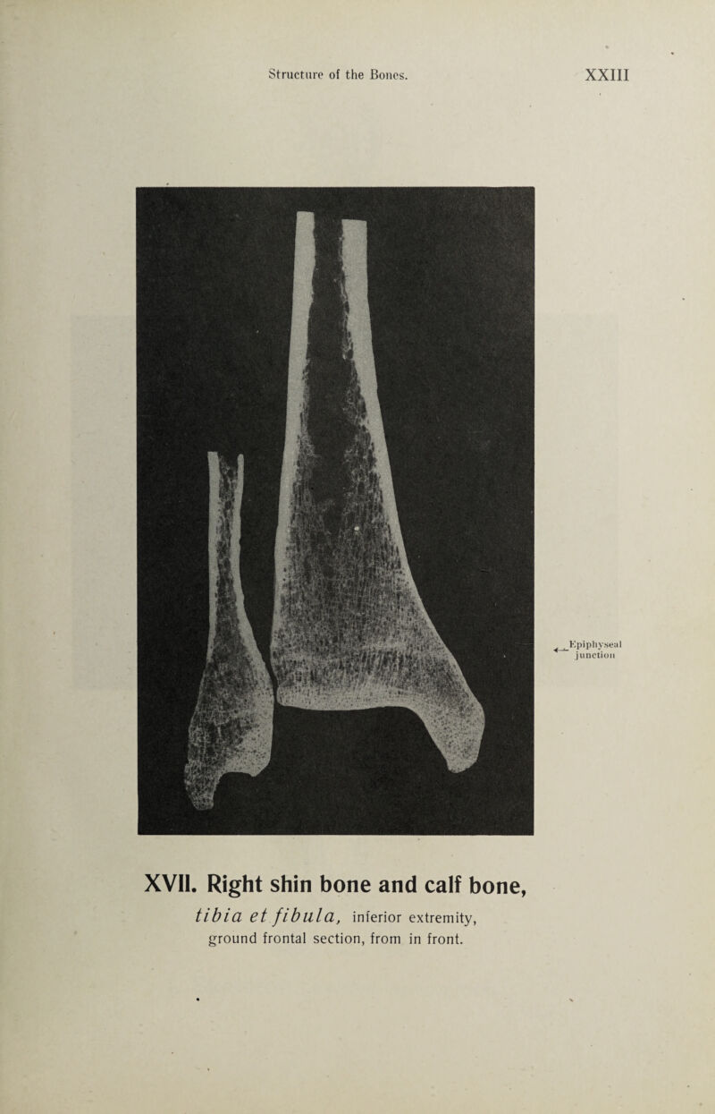 XVII. Right shin bone and calf bone, tlblCL 6t fibula, inferior extremity, ground frontal section, from in front. Epiphyseal junction