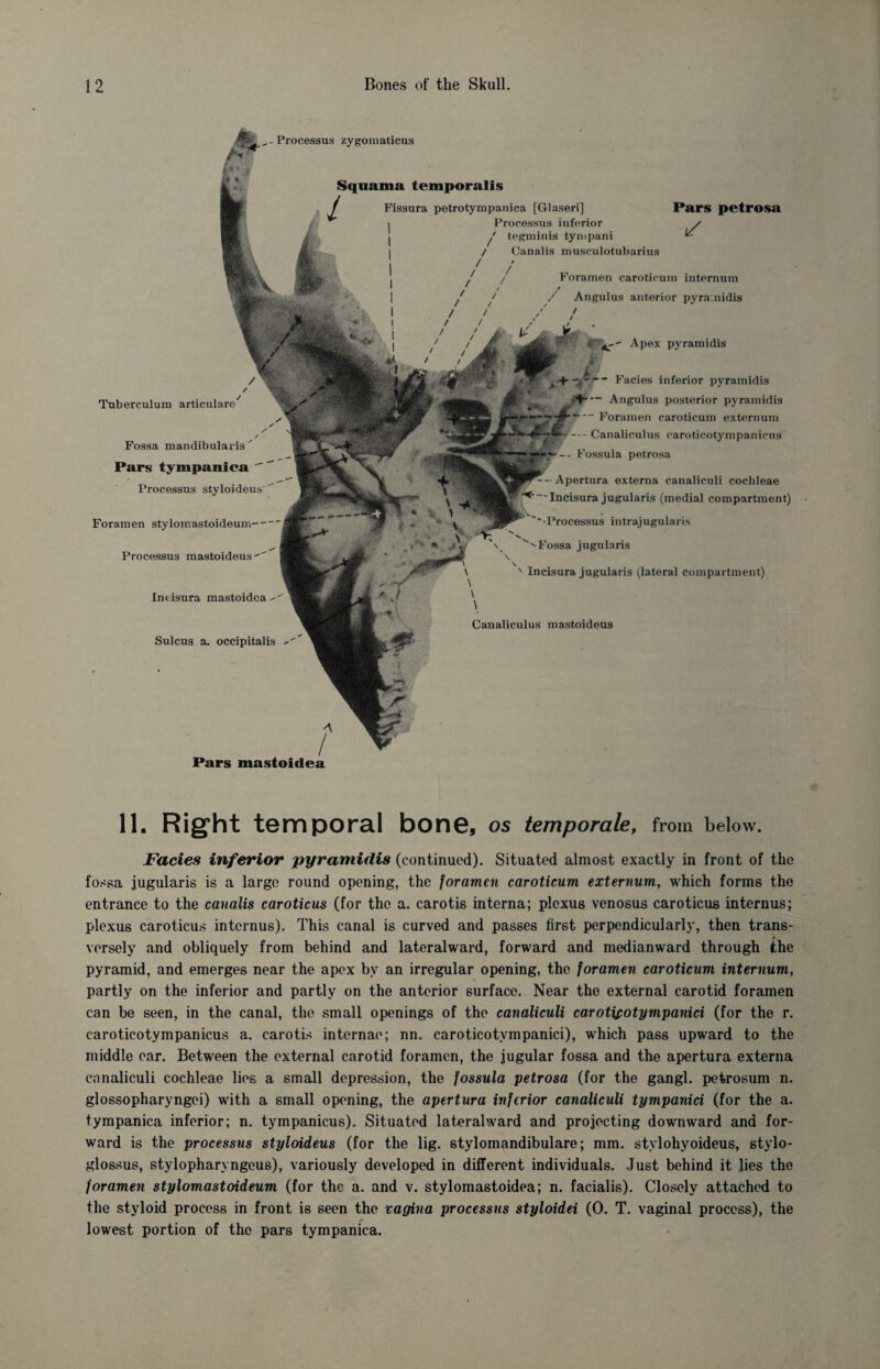 Processus zygomaticus Tuberculum articularo Fossa mandibularis Pars tympanica ' Processus styloideus Foramen stylomastoideum— Processus mastoideus Incisura mastoidca Sulcus a. occipitalis Squama temporalis Fissura petrotympanica [Glaseri] Processus inferior j tegminis tympani / / Canalis musculotubarius * Pars petrosa j/ Foramen caroticum internum * Angulus anterior pyramidis - Apex pyramidis Facies inferior pyramidis Angulus posterior pyramidis ■“ Foramen caroticum externum — Canaliculus caroticotympanicus - Fossula petrosa Apertura externa canaliculi cochleae Incisura jugularis (medial compartment) ''•Processus intrajugularis ^ Fossa jugularis Incisura jugularis (lateral compartment) Canaliculus mastoideus Pars mastoidea 11. Right temporal bone, os temporale, from below. Facies inferior pyramidis (continued). Situated almost exactly in front of the fossa jugularis is a large round opening, the foramen caroticum externum, which forms the entrance to the canalis caroticus (for the a. carotis interna; plexus venosus caroticus internus; plexus caroticus internus). This canal is curved and passes first perpendicularly, then trans¬ versely and obliquely from behind and lateralward, forward and medianward through the pyramid, and emerges near the apex by an irregular opening, the foramen caroticum internum, partly on the inferior and partly on the anterior surface. Near the external carotid foramen can be seen, in the canal, the small openings of the canaliculi carotifotympanici (for the r. caroticotympanicus a. carotis internae; nn. caroticotvmpanici), which pass upward to the middle ear. Between the external carotid foramen, the jugular fossa and the apertura externa canaliculi cochleae lies a small depression, the fossula petrosa (for the gangl. petrosum n. glossopharyngoi) with a small opening, the apertura inferior canaliculi tympanici (for the a. tympanica inferior; n. tympanicus). Situated lateralward and projecting downward and for¬ ward is the processus styloideus (for the lig. stylomandibulare; mm. stylohyoideus, stylo¬ glossus, stylopharyngeus), variously developed in different individuals. Just behind it lies the foramen stylomastoideum (for the a. and v. stylomastoidea; n. facialis). Closely attached to the styloid process in front is seen the vagina processus styloidei (0. T. vaginal process), the lowest portion of the pars tympanica.