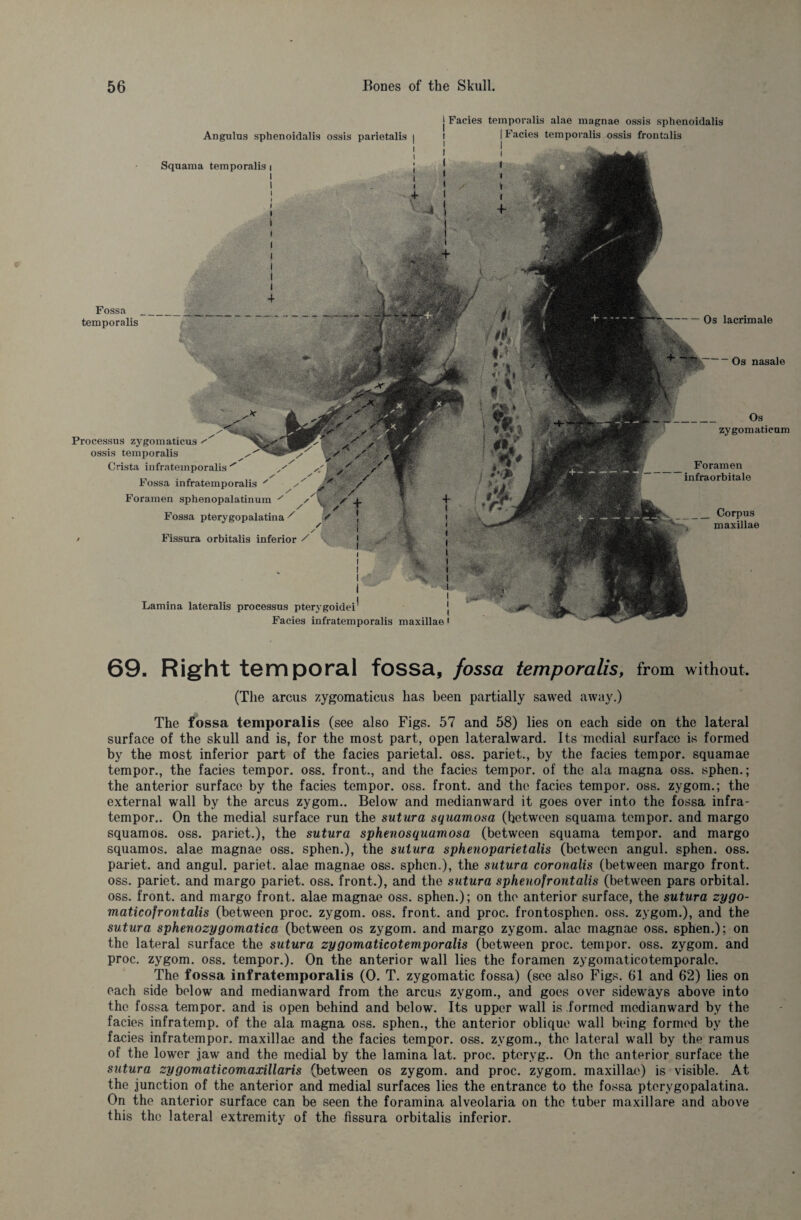 Angulus sphenoidalis ossis parietalis | Squama temporalis i j Facies temporalis alae magnae ossis sphenoidalis Facies temporalis ossis frontalis Fossa temporalis + & 1 v.:- # % f ■■ >' i ■ ' < \ j»» - tiflr U M ; J ; % Processus zygomaticus ossis temporalis Crista infratemporalis ^ Fossa infratemporalis Foramen sphenopalatinum Fossa pterygopalatina / • Fissura orbitalis inferior / Lamina lateralis processus pterygoidei -Os lacrimale — Os nasale Os zygomaticum Foramen infraorbitale _Corpus maxillae Facies infratemporalis maxillae 69. Right temporal fossa, fossa temporalis, from without. (The arcus zygomaticus has been partially sawed away.) The fossa temporalis (see also Figs. 57 and 58) lies on each side on the lateral surface of the skull and is, for the most part, open lateralward. Its medial surface is formed by the most inferior part of the facies parietal, oss. pariet., by the facies tempor. squamae tempor., the facies tempor. oss. front., and the facies tempor. of the ala magna oss. sphen.; the anterior surface by the facies tempor. oss. front, and the facies tempor. oss. zygom.; the external wall by the arcus zygom.. Below and medianward it goes over into the fossa infra- tempor.. On the medial surface run the sutura squamosa (hetween squama tempor. and margo squamos. oss. pariet.), the sutura sphenosquamosa (between squama tempor. and margo squamos. alae magnae oss. sphen.), the sutura sphenoparietalis (between angul. sphen. oss. pariet. and angul. pariet. alae magnae oss. sphen.), the sutura coronalis (between margo front, oss. pariet. and margo pariet. oss. front.), and the sutura sphenofrontalis (between pars orbital, oss. front, and margo front, alae magnae oss. sphen.); on the anterior surface, the sutura zygo- maticofrontalis (between proc. zygom. oss. front, and proc. frontosphen. oss. zygom.), and the sutura sphenozygomatica (between os zygom. and margo zygom. alae magnae oss. sphen.): on the lateral surface the sutura zygomaticotemporalis (between proc. tempor. oss. zygom. and proc. zygom. oss. tempor.). On the anterior wall lies the foramen zygomaticotemporale. The fossa infratemporalis (0. T. zygomatic fossa) (see also Figs. 61 and 62) lies on each side below and medianward from the arcus zygom., and goes over sideways above into the fossa tempor. and is open behind and below. Its upper wall is formed medianward by the facies infratemp, of the ala magna oss. sphen., the anterior oblique wall being formed by the facies infratempor. maxillae and the facies tempor. oss. zygom., the lateral wall by the ramus of the lower jaw and the medial by the lamina lat. proc. pteryg.. On the anterior surface the sutura zygomaticomaxillaris (between os zygom. and proc. zygom. maxillae) is visible. At the junction of the anterior and medial surfaces lies the entrance to the fossa pterygopalatina. On the anterior surface can be seen the foramina alveolaria on the tuber maxillare and above this the lateral extremity of the fissura orbitalis inferior.