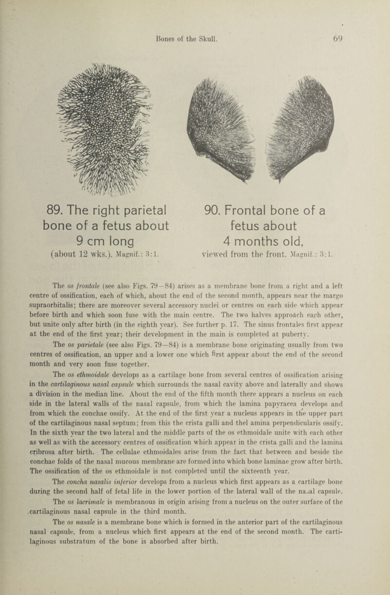 89. The right parietal bone of a fetus about 9 cm long (about 12 wks.). Magnif.: 3:1. 90. Frontal bone of a fetus about 4 months old, viewed from the front. Magnif.: 3:1. The os frontale (see also Figs. 79—84) arises as a membrane bone from a right and a left centre of ossification, each of which, about the end of the second month, appears near the margo supraorbitalis; there are moreover several accessory nuclei or centres on each side which appear before birth and which soon fuse with the main centre. The two halves approach each other, but unite only after birth (in the eighth year). See further p. 17. The sinus frontales first appear at the end of the first year; their development in the main is completed at puberty. The os parietale (see also Figs. 79—84) is a membrane bone originating usually from two centres of ossification, an upper and a lower one which first appear about the end of the second month and very soon fuse together. The os ethmoidale develops as a cartilage bone from several centres of ossification arising in the cartilaginous nasal capsule which surrounds the nasal cavity above and laterally and shows a division in the median line. About the end of the fifth month there appears a nucleus on each side in the lateral walls of the nasal capsule, from which the lamina papvracea develops and from which the conchae ossify. At the end of the first year a nucleus appears in the upper part of the cartilaginous nasal septum; from this the crista galli and thel amina perpendicularis ossifv. In the sixth year the two lateral and the middle parts of the os ethmoidale unite with each other as well as with the accessory centres of ossification which appear in the crista galli and the lamina cribrosa after birth. The cellulae ethmoidales arise from the fact that between and beside the conchae folds of the nasal mucous membrane are formed into which bone laminae grow after birth. The ossification of the os ethmoidale is not completed until the sixteenth year. The concha nasalis inferior develops from a nucleus which first appears as a cartilage bone during the second half of fetal life in the lower portion of the lateral wall of the naoal capsule. The os lacrimale is membranous in origin arising from a nucleus on the outer surface of the .cartilaginous nasal capsule in the third month. The os nasale is a membrane bone which is formed in the anterior part of the cartilaginous nasal capsule, from a nucleus which first appears at the end of the second month. The carti¬ laginous substratum of the bone is absorbed after birth.
