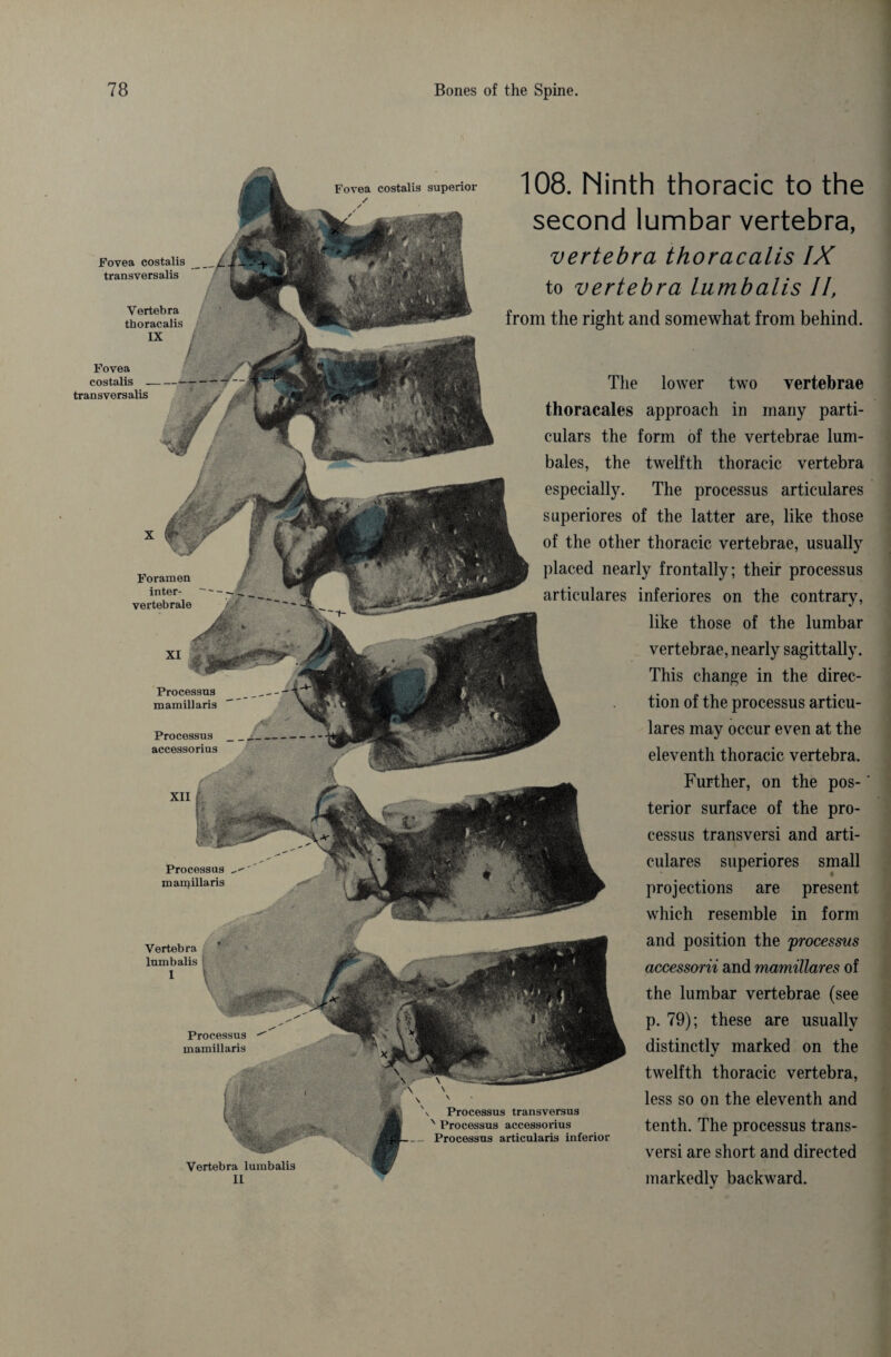 Fovea costalis superior Fovea costalis transversalis Vertebra thoracalis IX Fovea costalis transversalis Foramen inter- vertebrale Processus mamillaris Processus accessorius XII Processus mamillaris Vertebra lumbalis I Processus mamillaris Vertebra lumbalis II 108. Ninth thoracic to the second lumbar vertebra, vertebra thoracalis IX to vertebra lumbalis II, from the right and somewhat from behind. The lower two vertebrae thoracales approach in many parti¬ culars the form of the vertebrae lum¬ bales, the twelfth thoracic vertebra especially. The processus articulares superiores of the latter are, like those of the other thoracic vertebrae, usually placed nearly frontally; their processus articulares inferiores on the contrary, like those of the lumbar vertebrae, nearly sagittally. This change in the direc¬ tion of the processus articu¬ lares may occur even at the eleventh thoracic vertebra. Further, on the pos¬ terior surface of the pro¬ cessus transversi and arti¬ culares superiores small projections are present which resemble in form and position the 'processus accessorii and mamillares of the lumbar vertebrae (see p. 79); these are usually distinctly marked on the twelfth thoracic vertebra, less so on the eleventh and tenth. The processus trans¬ versi are short and directed markedly backward. Processus transversus Processus accessorius Processus articularis inferior