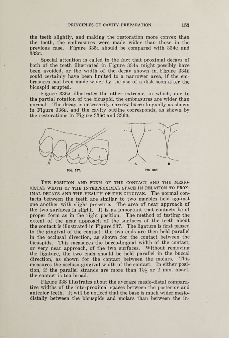the teeth slightly, and making the restoration more convex than the tooth, the embrasures were made wider than those in the previous case. Figure 335c should be compared with 334c and 333c. Special attention is called to the fact that proximal decays of both of the teeth illustrated in Figure 334a might possibly have been avoided, or the width of the decay shown in Figure 334b could certainly have been limited to a narrower area, if the em¬ brasures had been made wider by the use of a disk soon after the bicuspid erupted. Figure 336a illustrates the other extreme, in which, due to the partial rotation of the bicuspid, the embrasures are wider than normal. The decay is necessarily narrow bucco-lingually as shown in Figure 336b, and the cavity outline corresponds, as shown by the restorations in Figure 336c and 336d. Fig. 838. The POSITION AND FORM OF THE CONTACT AND THE MESIO- DISTAL WIDTH OF THE INTERPROXIMAL SPACE IN RELATION TO PROX¬ IMAL DECAYS AND THE HEALTH OF THE GINGIVAE. The normal con¬ tacts between the teeth are similar to two marbles held against one another with slight pressure. The area of near approach of the two surfaces is slight. It is as important that contacts be of proper form as in the right position. The method of testing the extent of the near approach of the surfaces of the teeth about the contact is illustrated in Figure 337. The ligature is first passed to the gingival of the contact; the two ends are then held parallel in the occlusal direction, as shown for the contact between the bicuspids. This measures the bucco-lingual width of the contact, or very near approach, of the two surfaces. Without removing the ligature, the two ends should be held parallel in the buccal direction, as shown for the contact between the molars. This measures the occluso-gingival width of the contact. In either posi¬ tion, if the parallel strands are more than IV2 or 2 mm. apart, the contact is too broad. Figure 338 illustrates about the average mesio-distal compara¬ tive widths of the interproximal spaces between the posterior and anterior teeth. It will be noticed that the base is much wider mesio- distally between the bicuspids and molars than between the in-